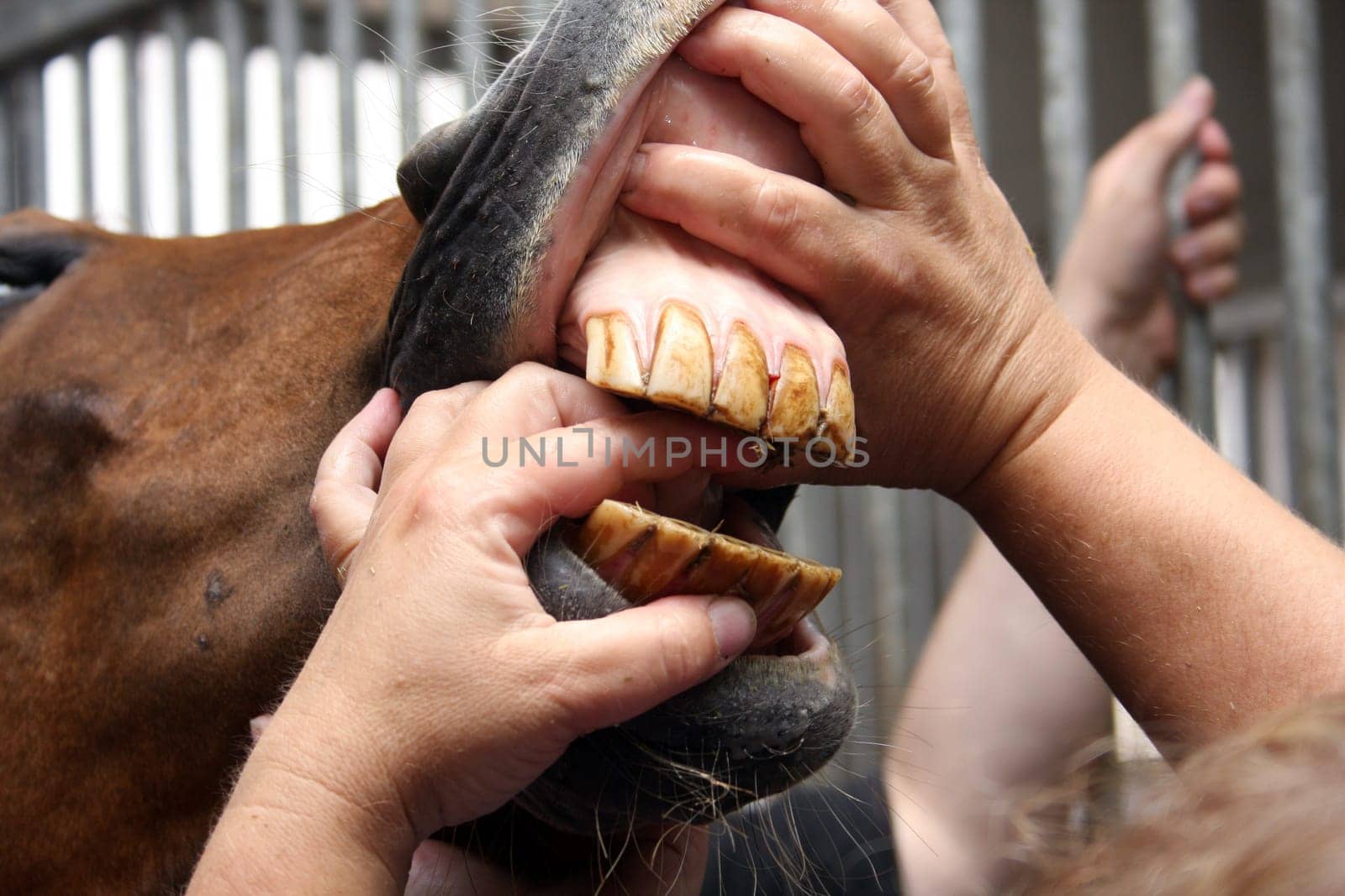 Dentition control