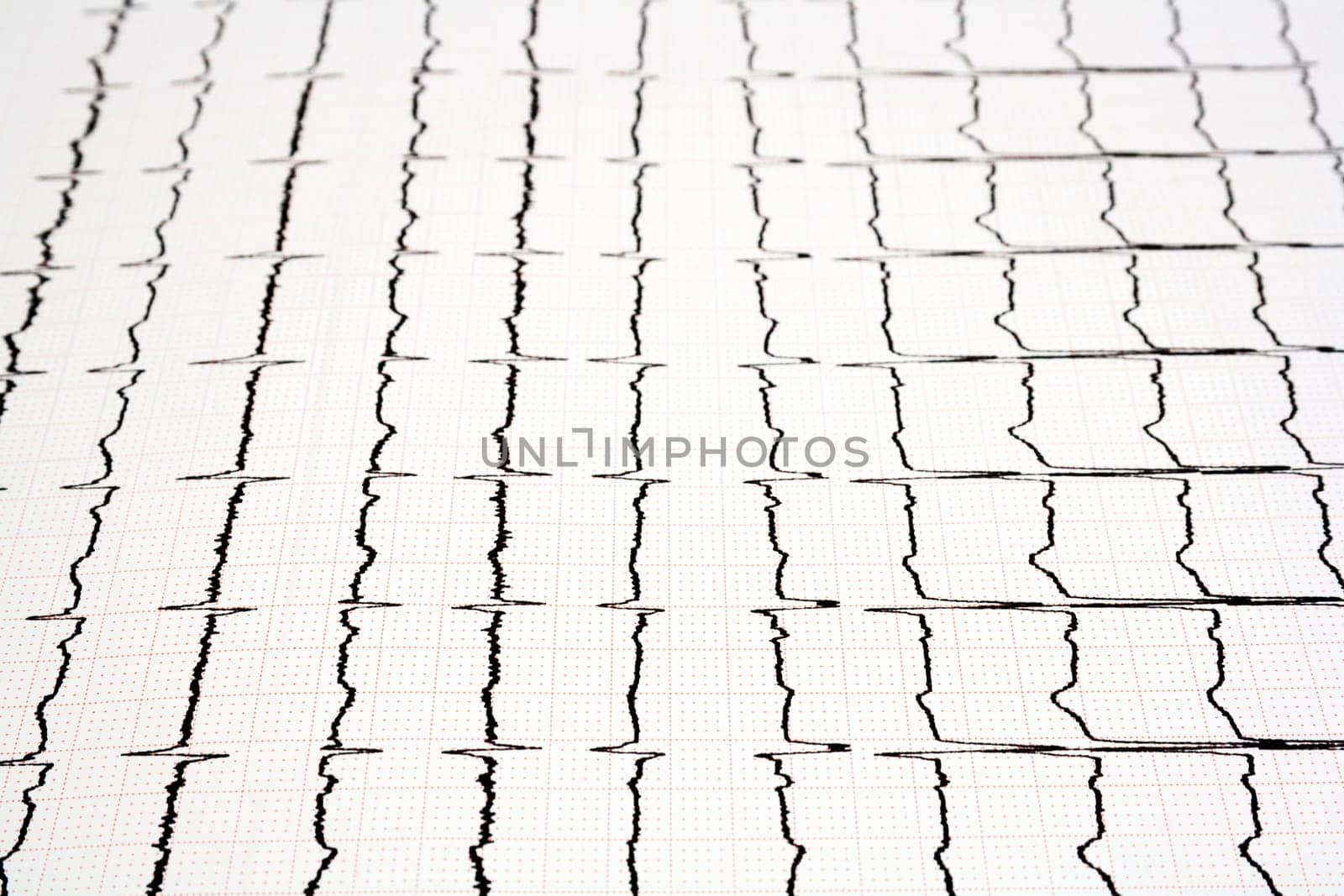 ECG print