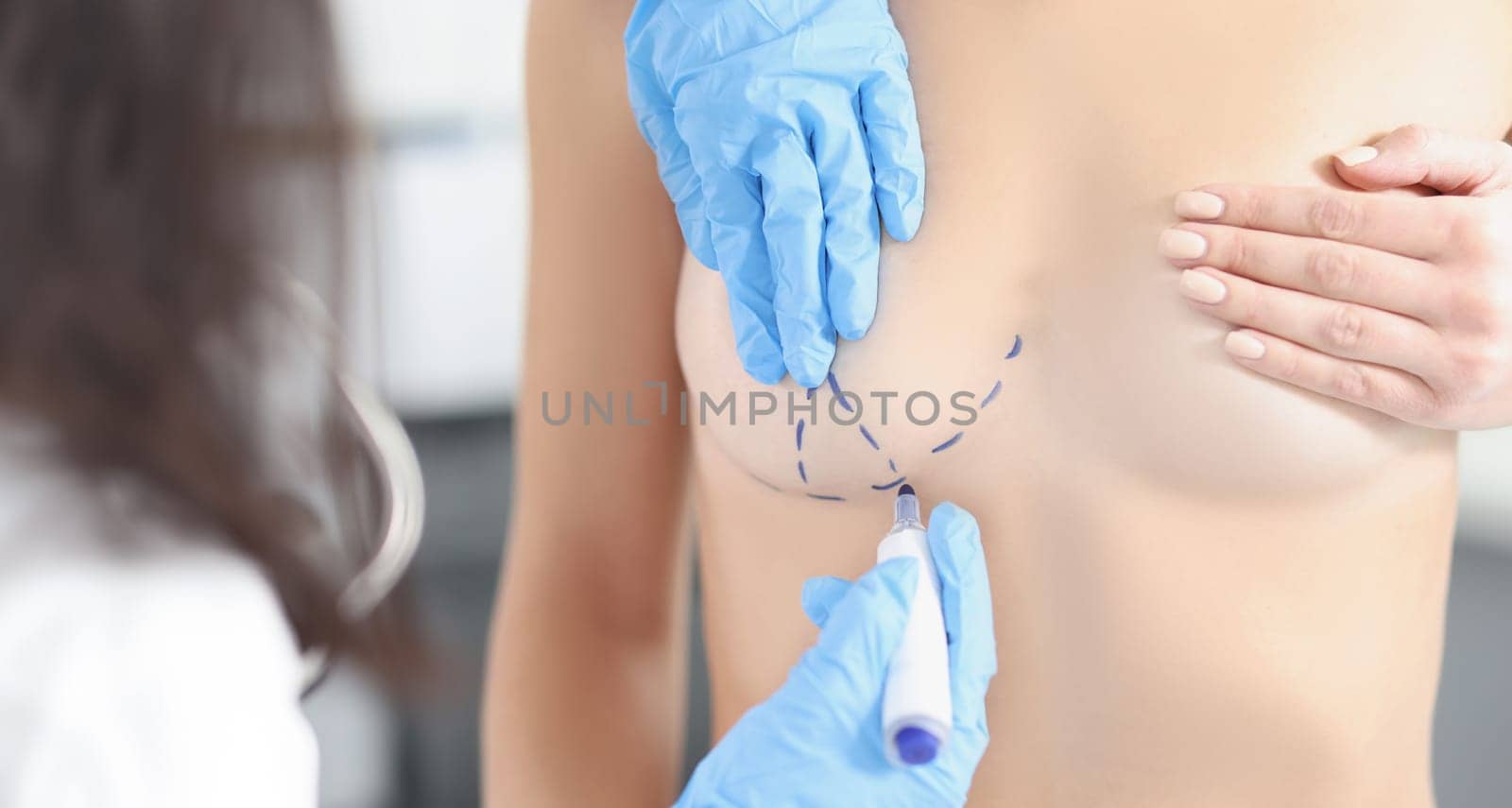 Patient close breast with hand, doctor put black marks on boob for surgery by kuprevich