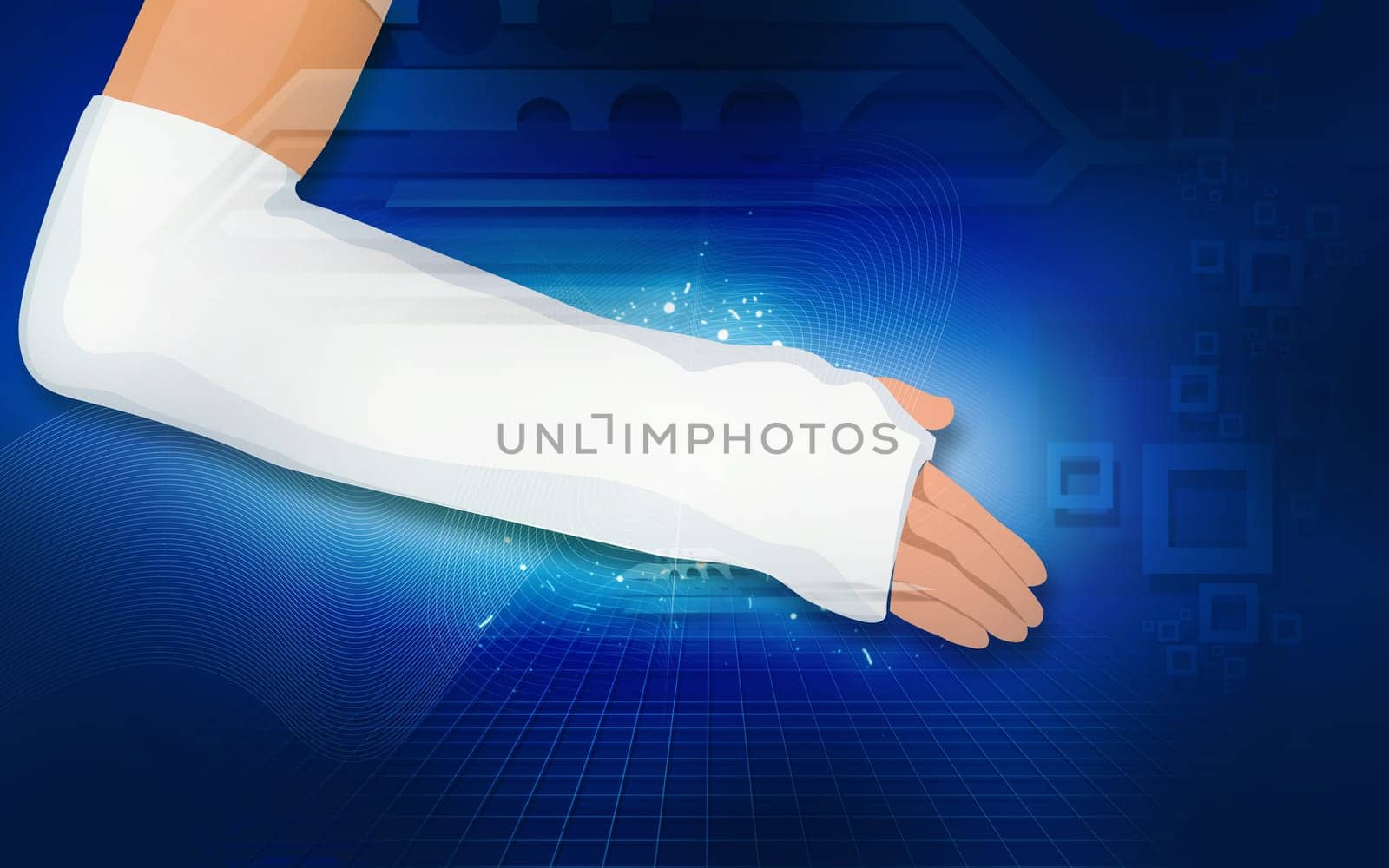 Illustration of a hand with bandages