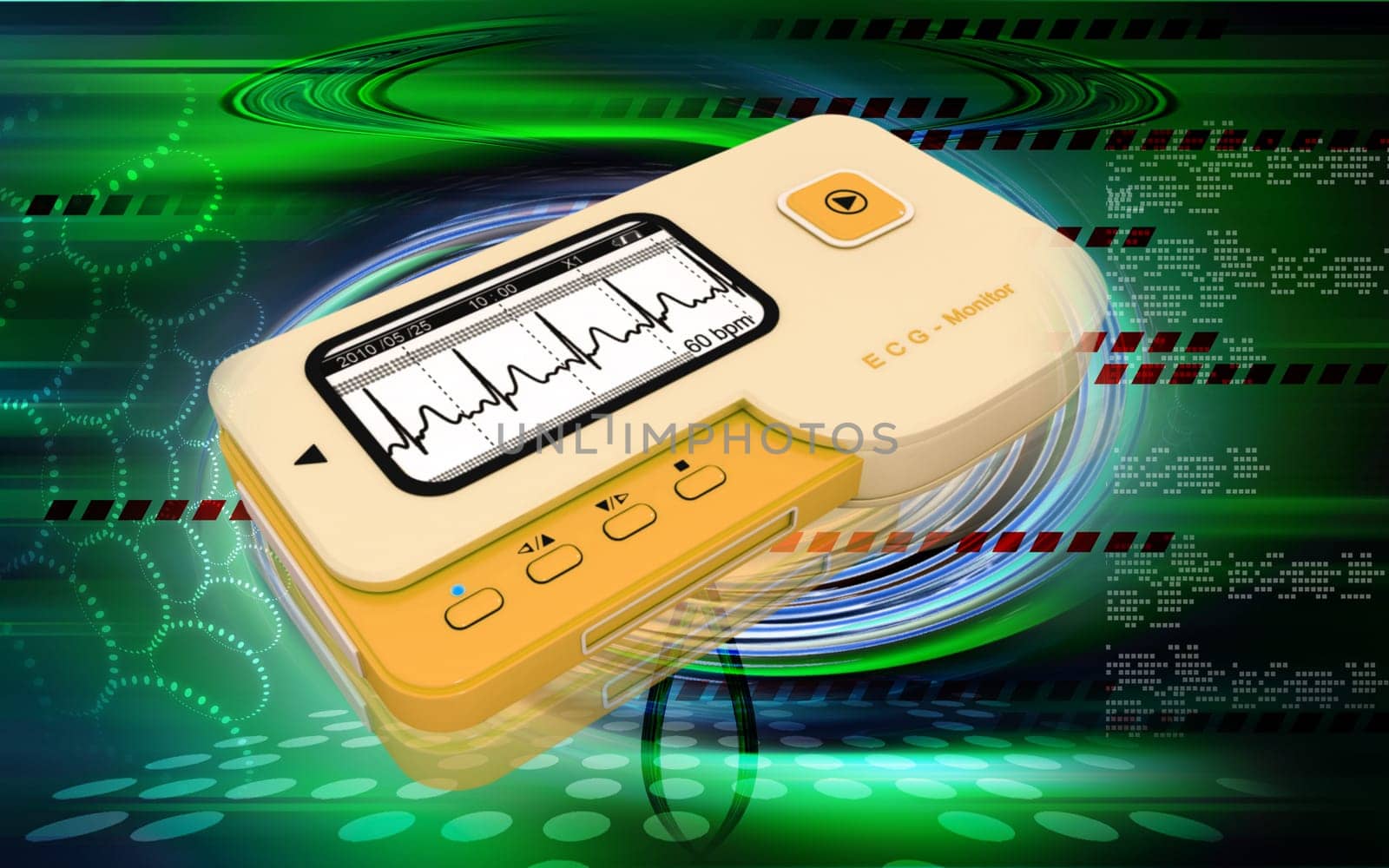 ECG