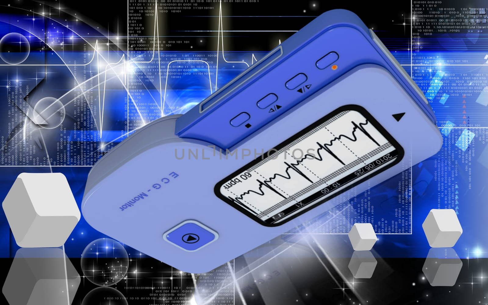 ECG