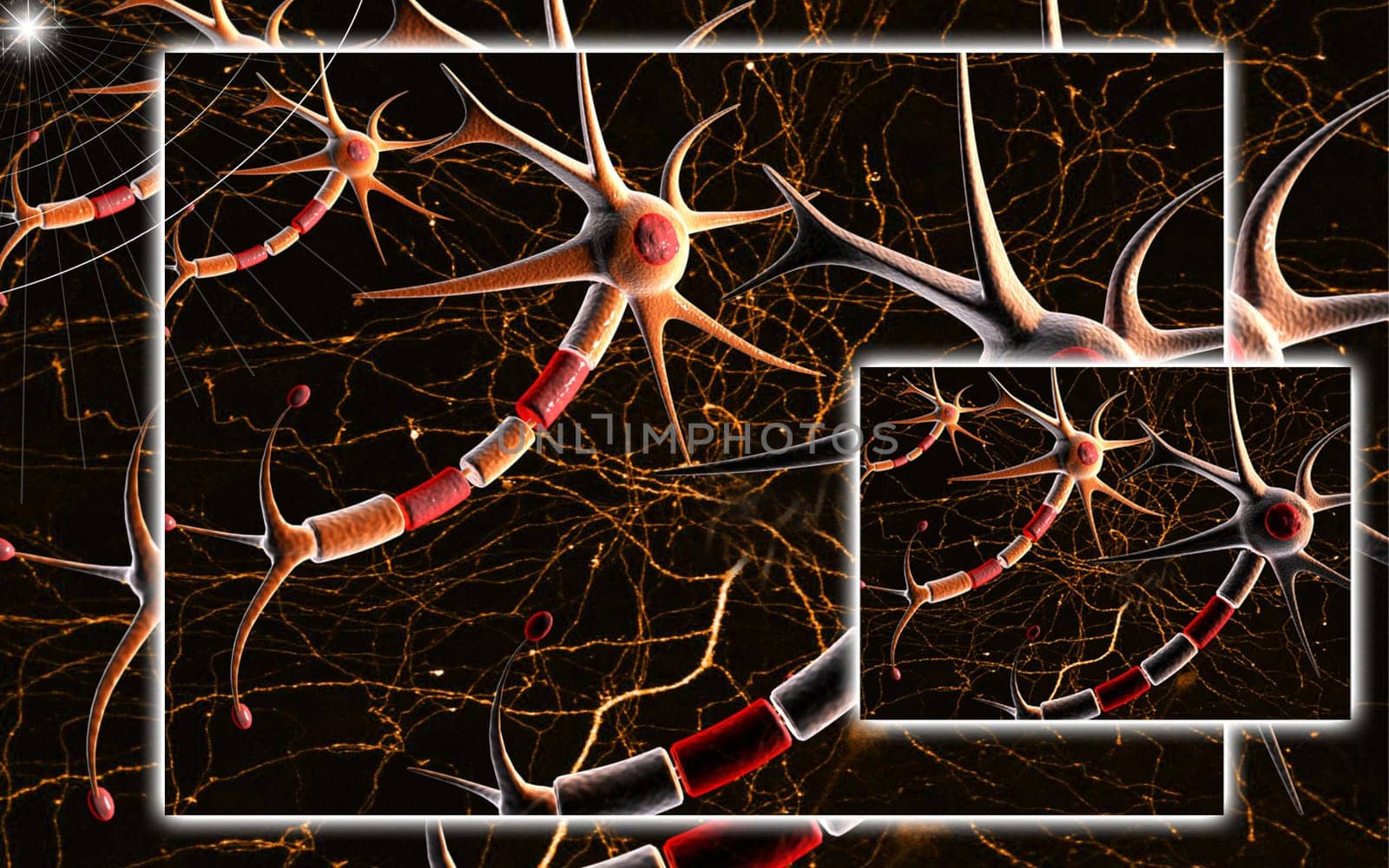 Neuron