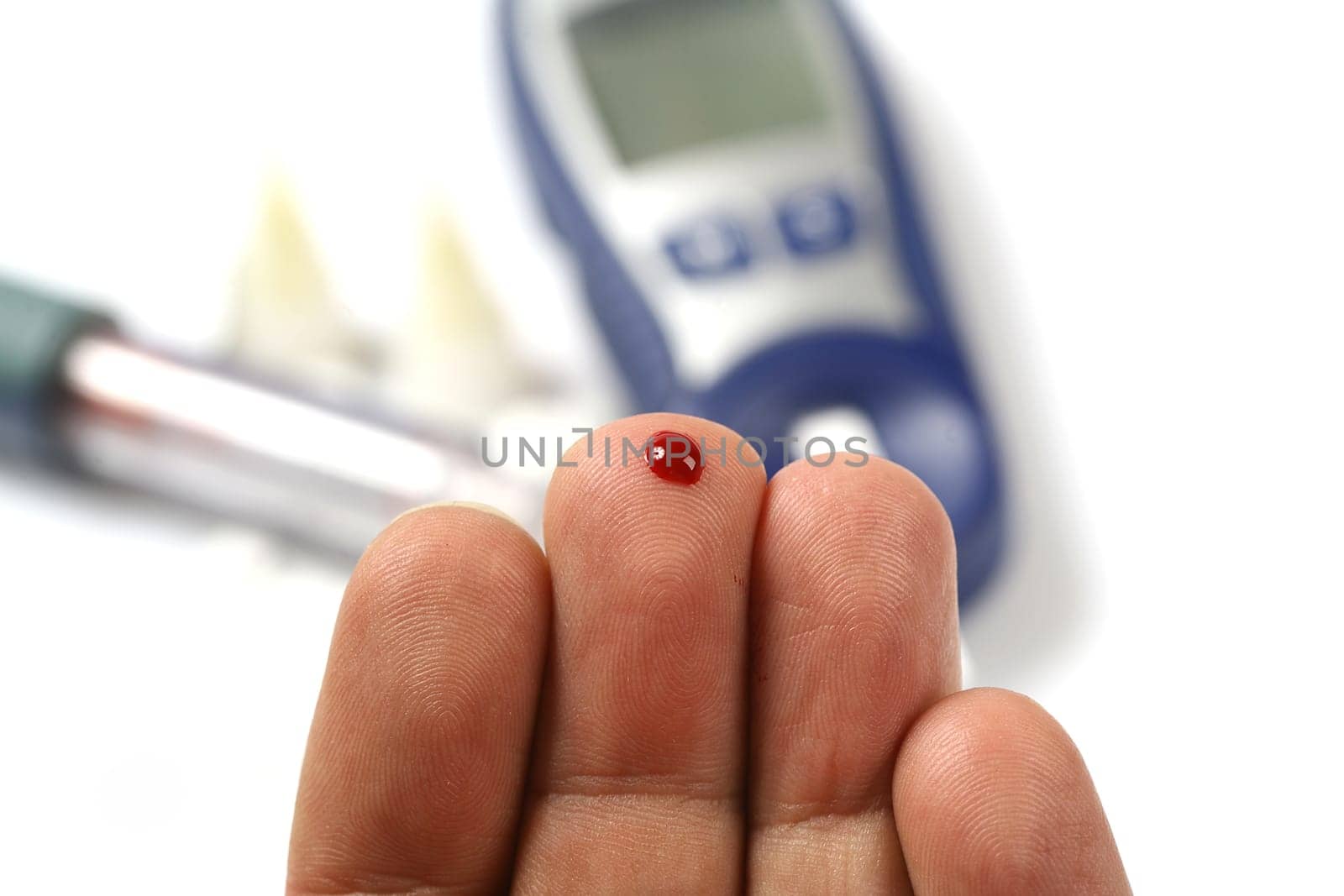 glucose measurement