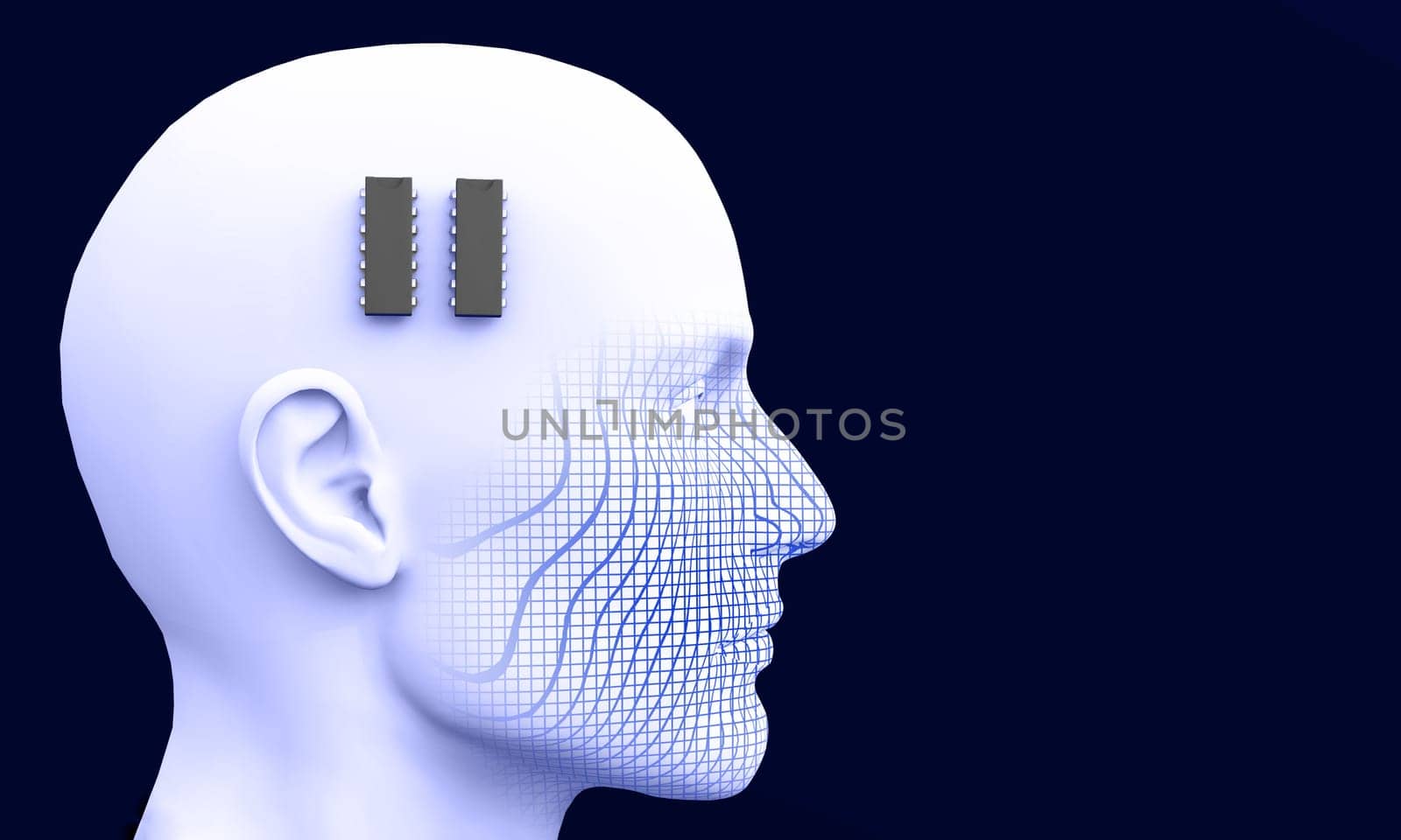 3D - IC Brain Pacemaker Concept - 01