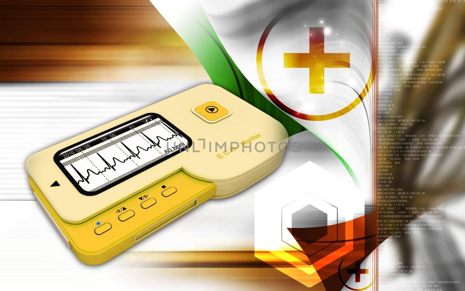 ECG