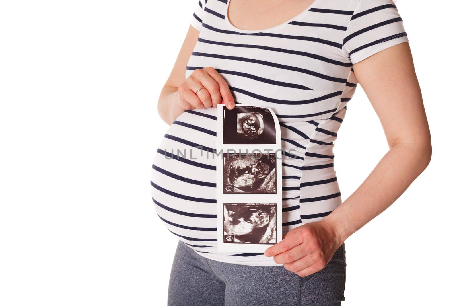 Pregnant woman standing and holding her ultrasound baby scan by dimol