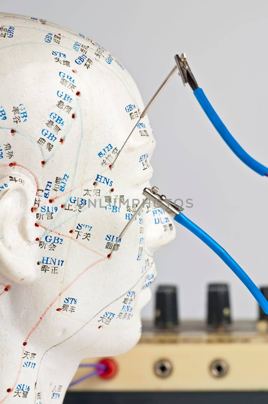 Electro-Acupuncture