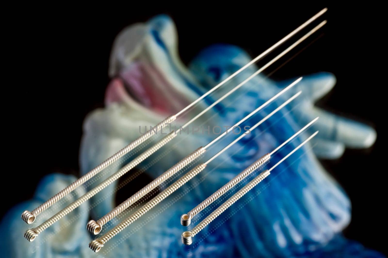 Acupuncture needles