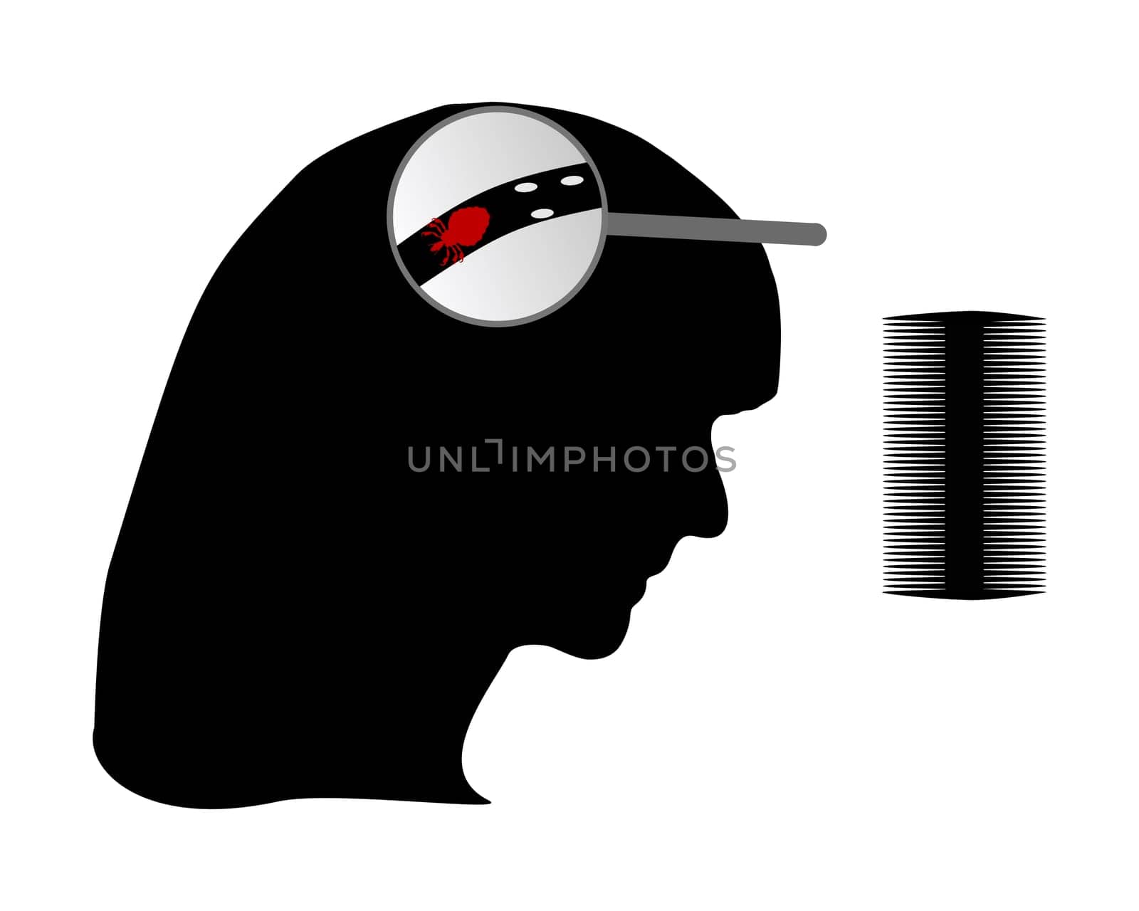 Woman's head,louse,nits and lice comb
