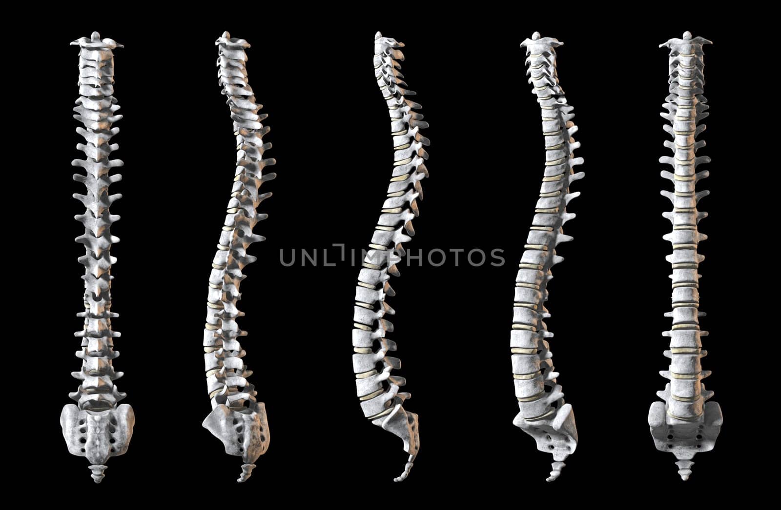 A total of five human spines shown at 5 angles to rerveal the whole object. Clipping Path Included!!!