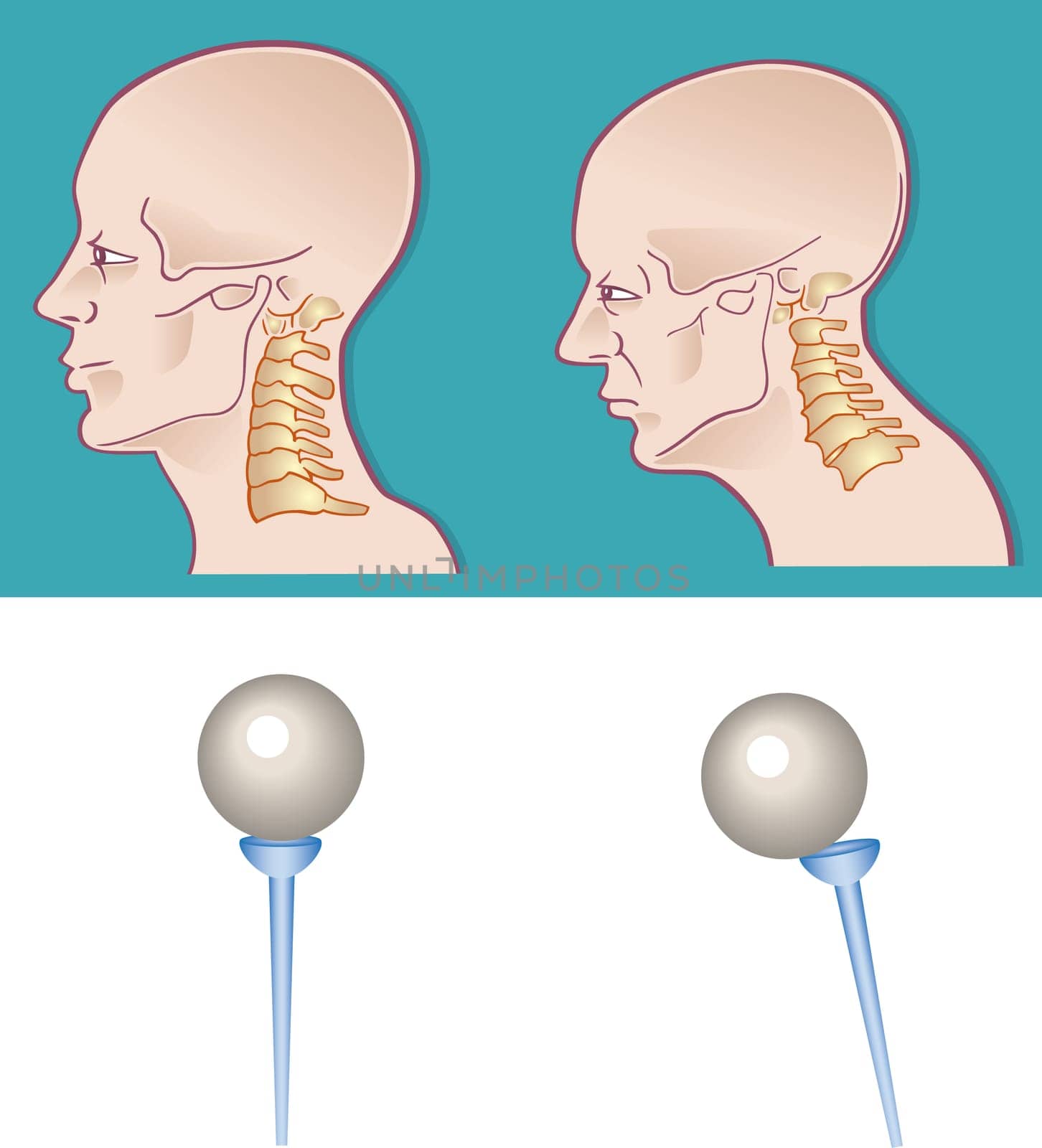 Illustration of neck spine cross section