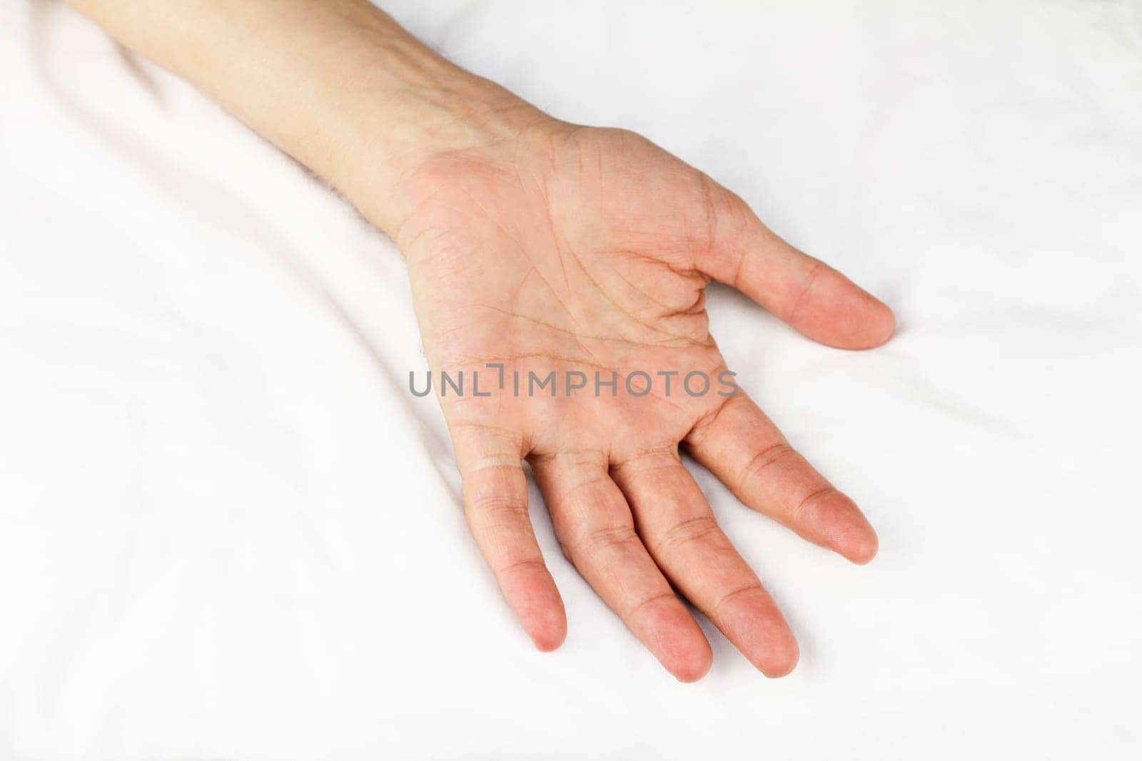 Open palm connected to an arm lying on a white massage table sheet.
