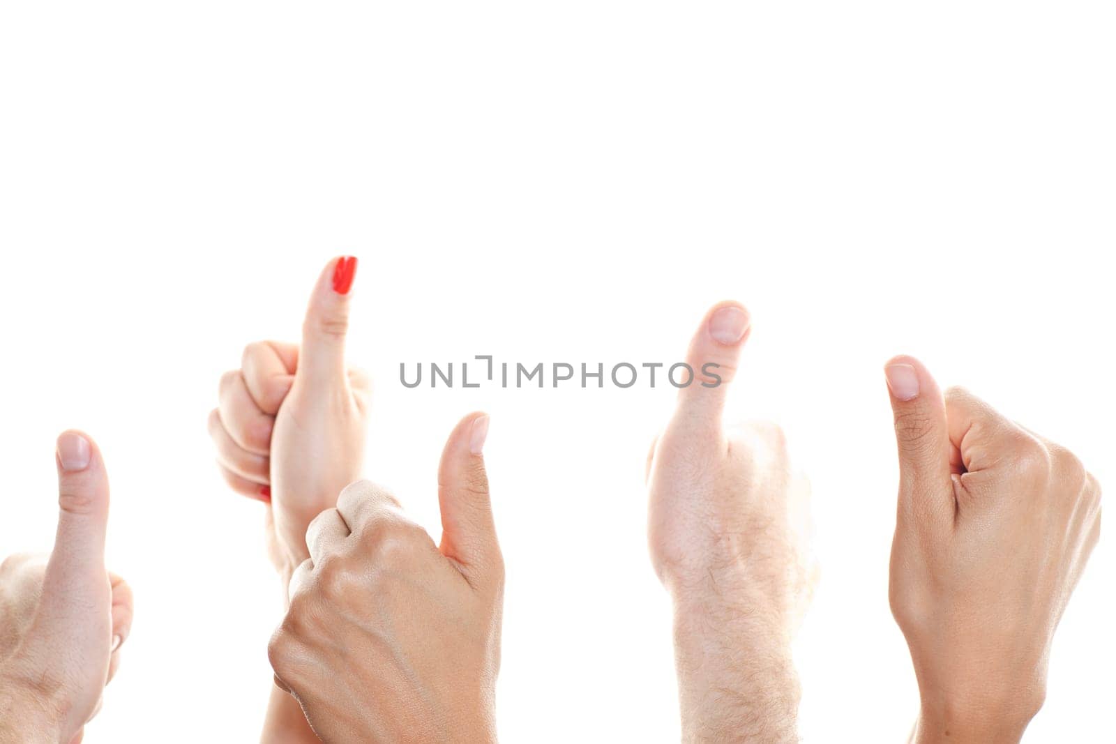 Many thumbs facing up against a white background