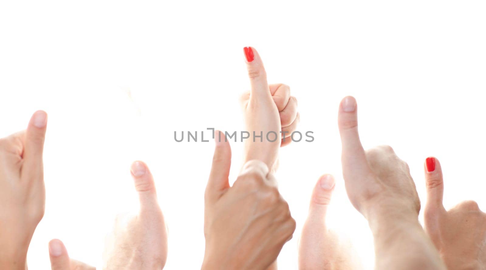 Many thumbs facing up against a white background
