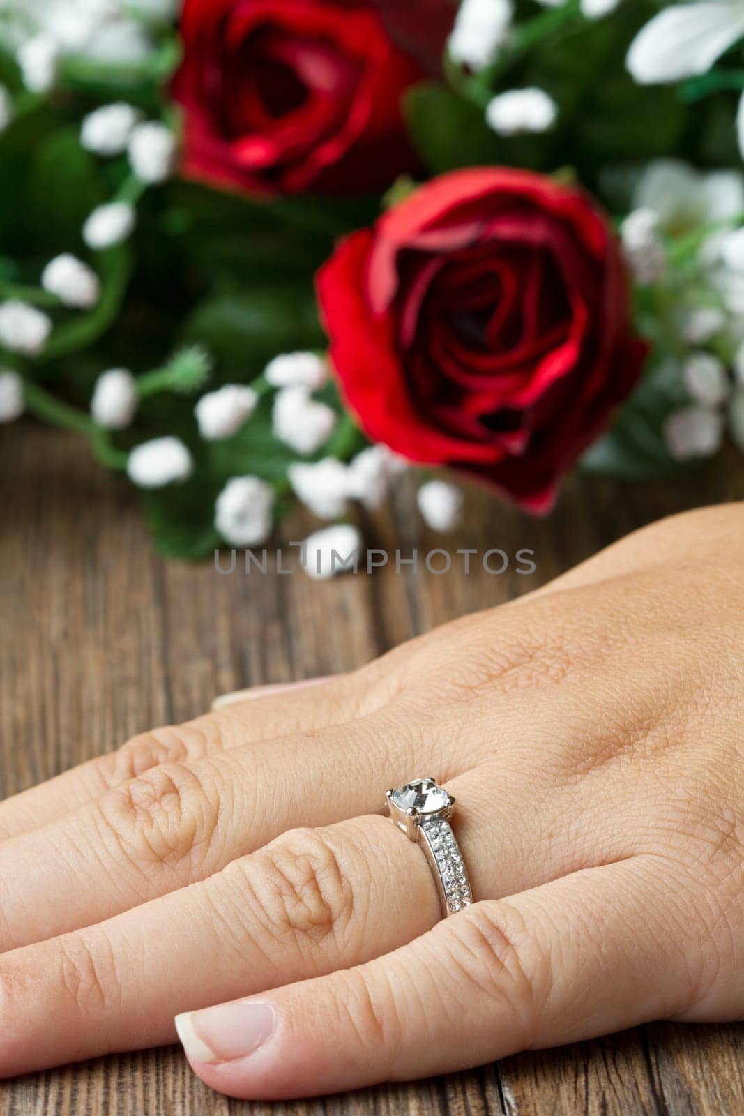 a ring diamond