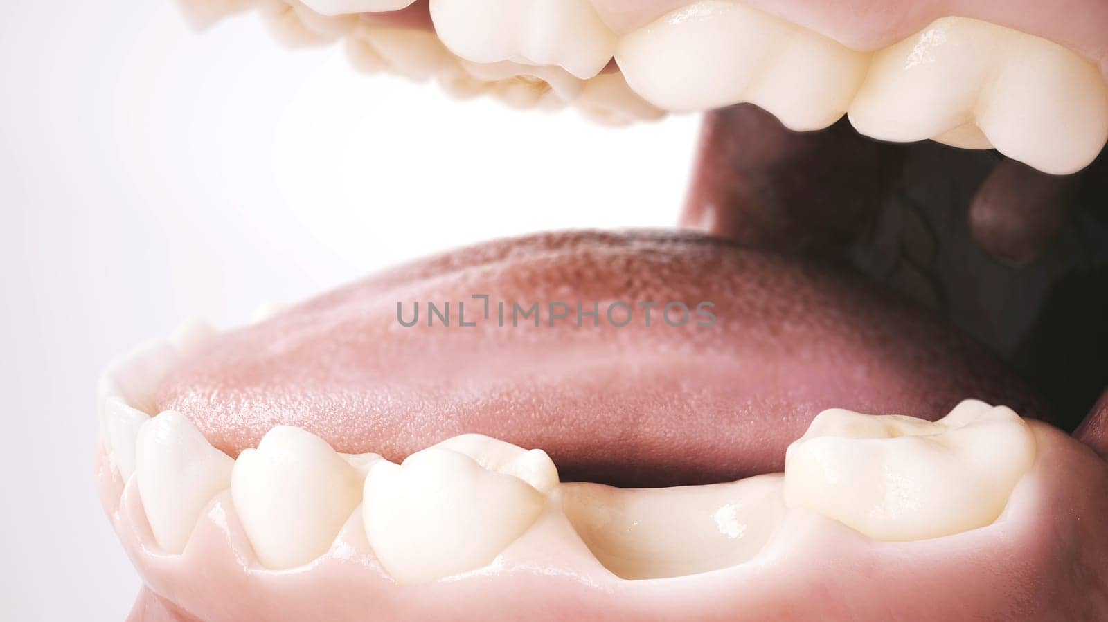 This image provides a detailed close-up of a human mouth, prominently highlighting a section of teeth. The incisors and molars, along with the soft pink gums, are depicted in great detail, emphasizing oral health. However, what stands out most is a noticeable gap between the teeth, indicating a missing tooth. This serves as a visual representation of the first part in a series, capturing the initial stage before any dental corrective procedures, such as the introduction of an implant.