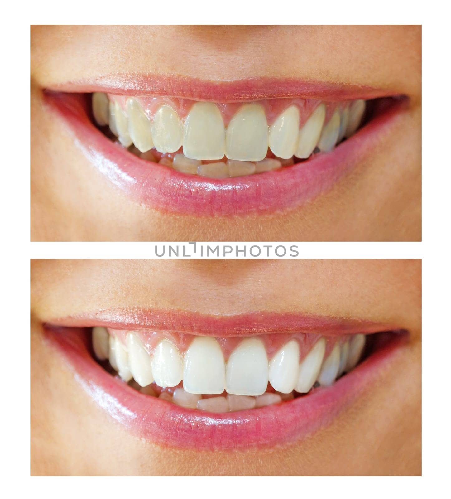 Bleaching effect - before and after