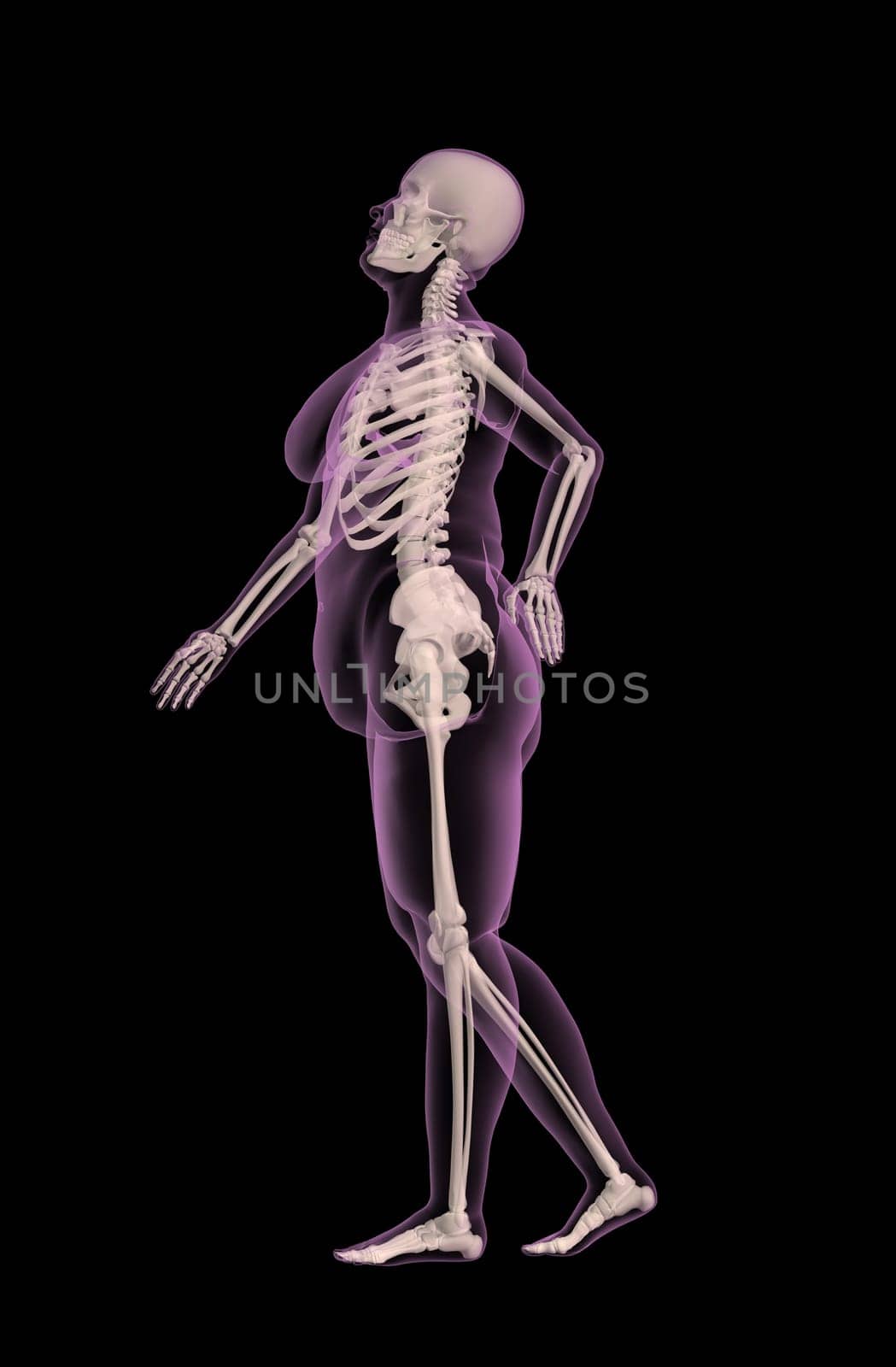 3D render of an overweight female medical skeleton with back pain