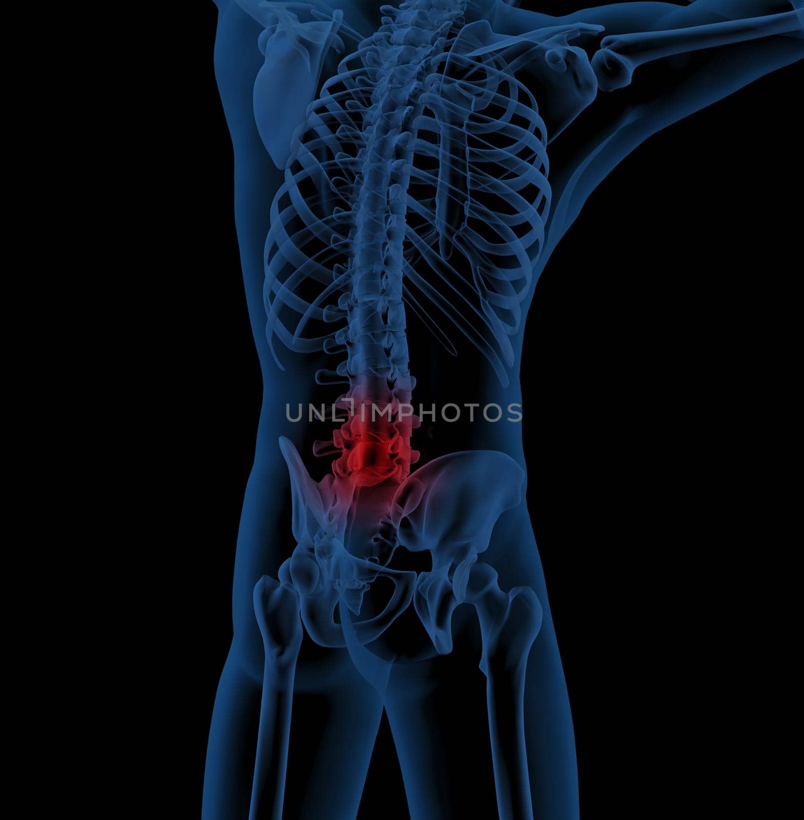 3D render of a medical skeleton illustrating back pain