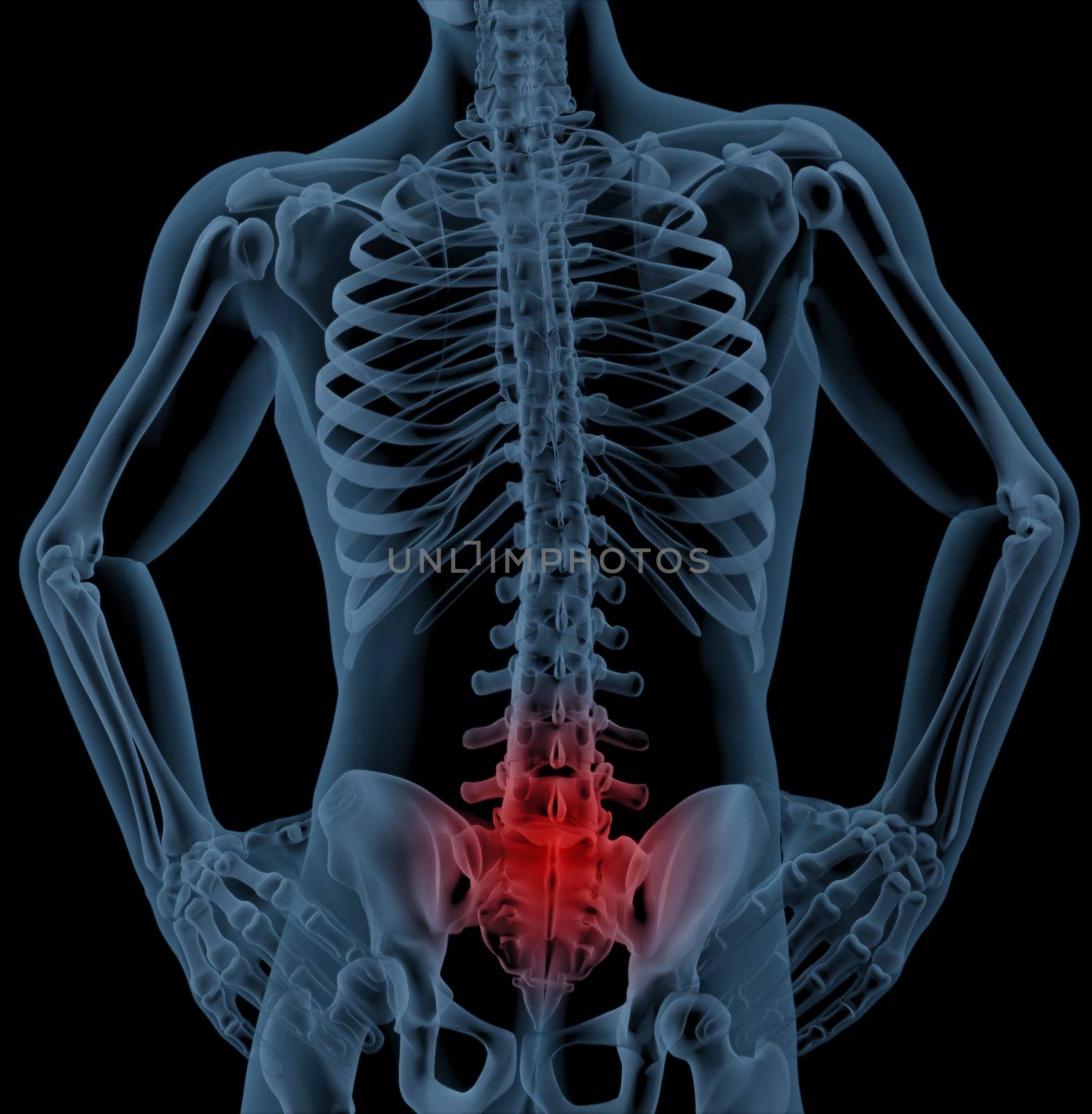3D render of a skeleton highlighting pain in the back