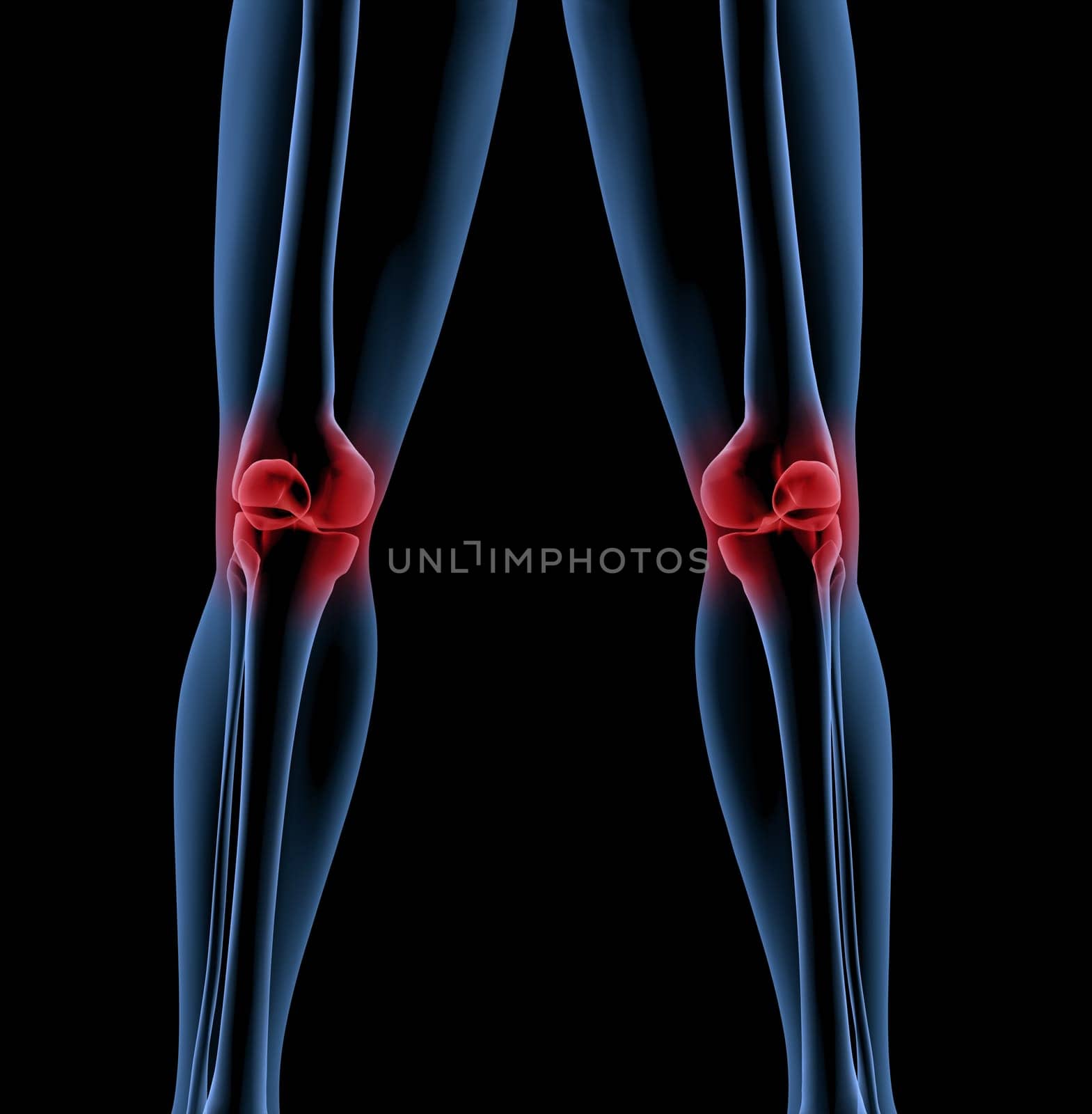 Medical skeleton with a close up of the legs showing pain in the knees