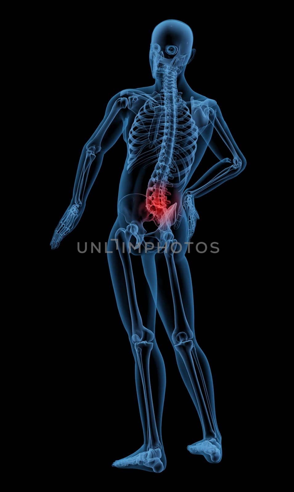 3D render of a skeleton highlighting pain in the back