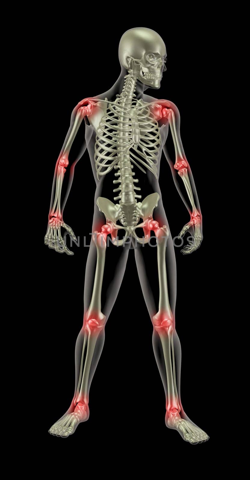 3D render of a medical skeleton with joints highlighted