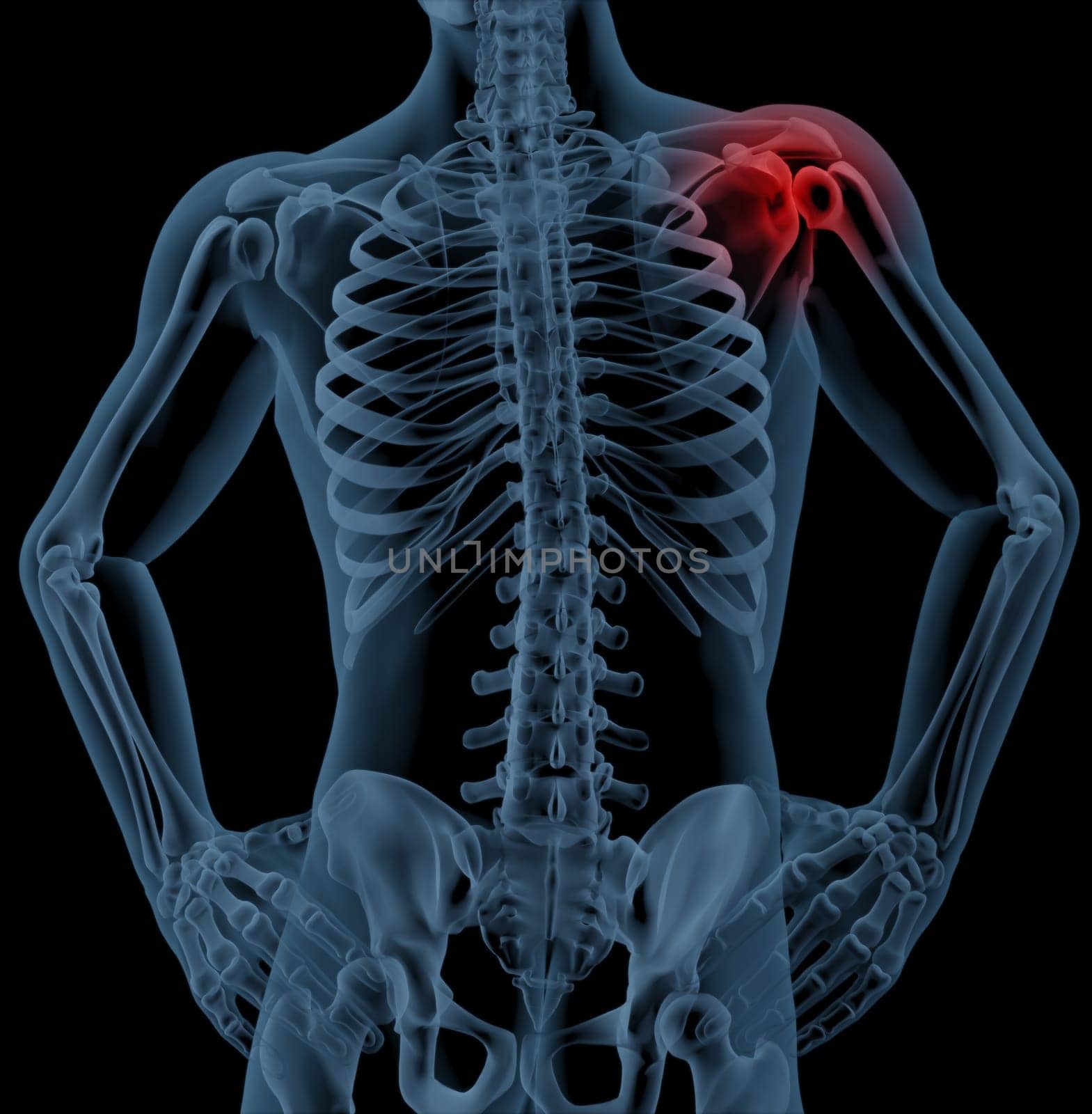 3D render of a medical skeleton with the shoulder joint highlighted