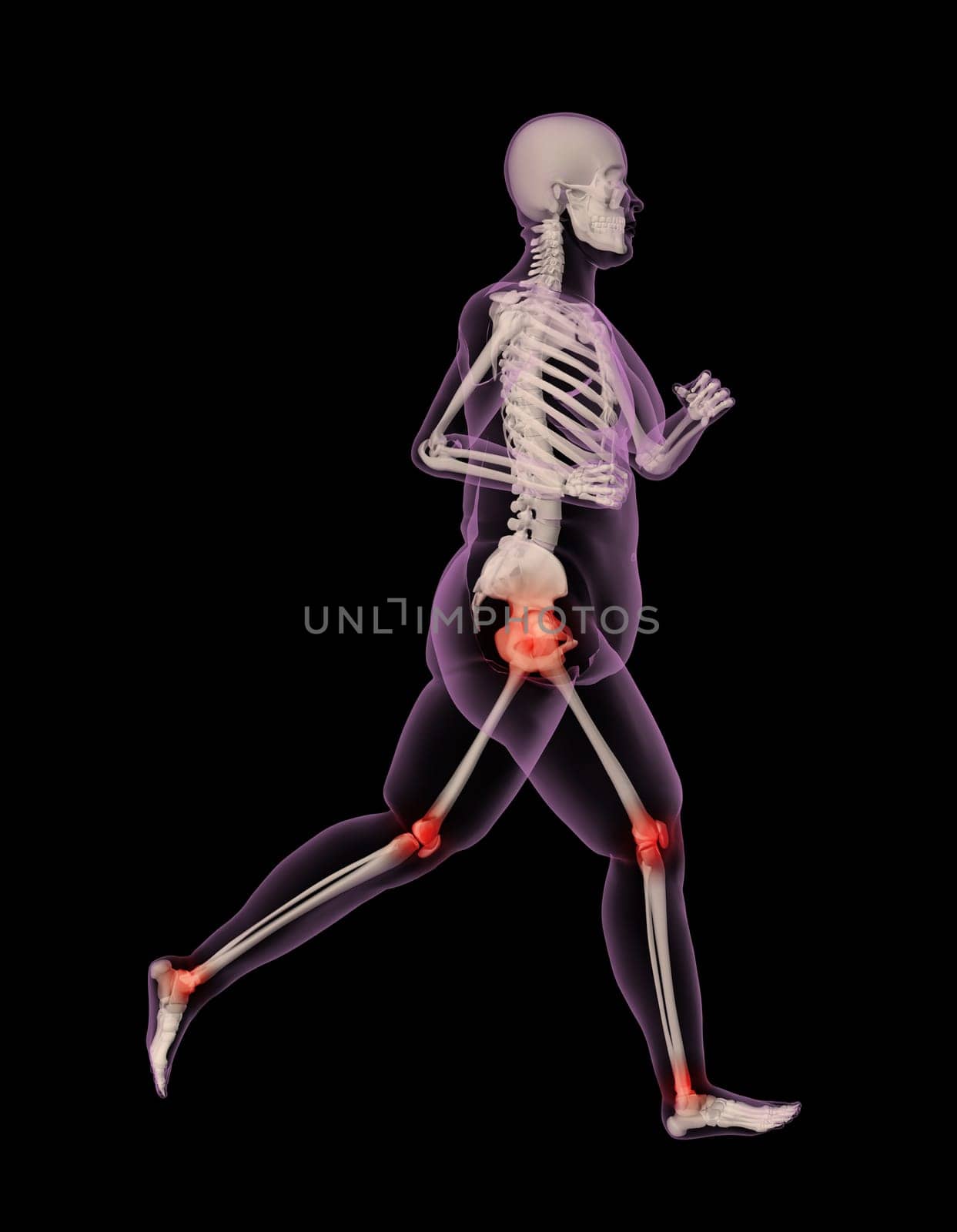 3D render of an overweight female skeleton running showing pressure points on joints