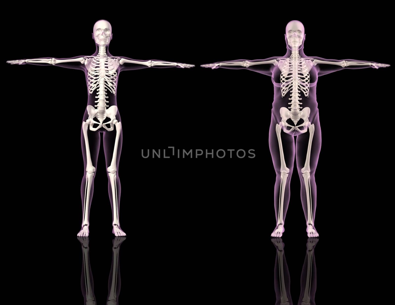 3D renders of two female skeletons one slim and one overweight