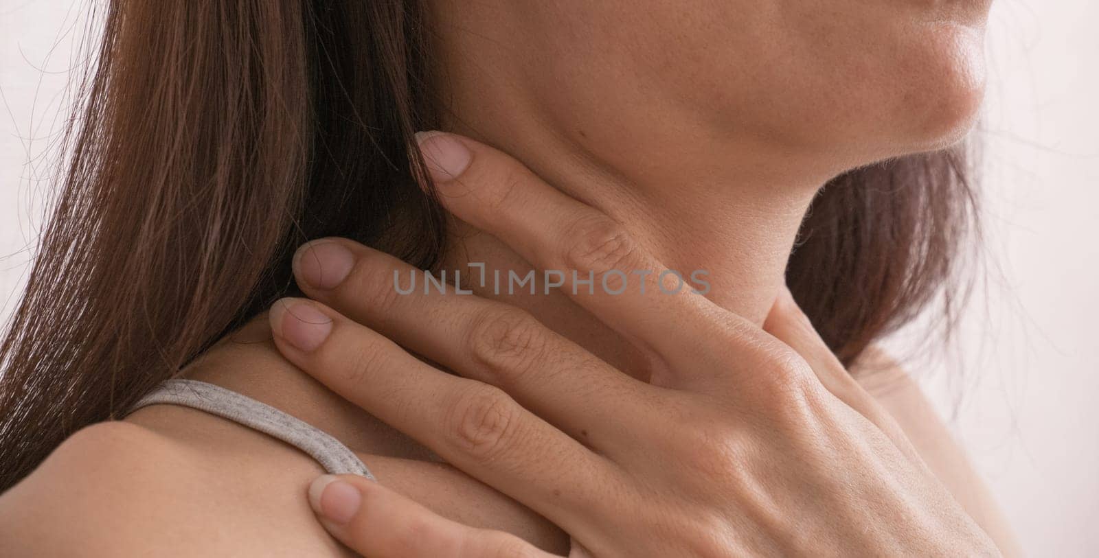 Cervical lymphadenitis of the right side in a woman