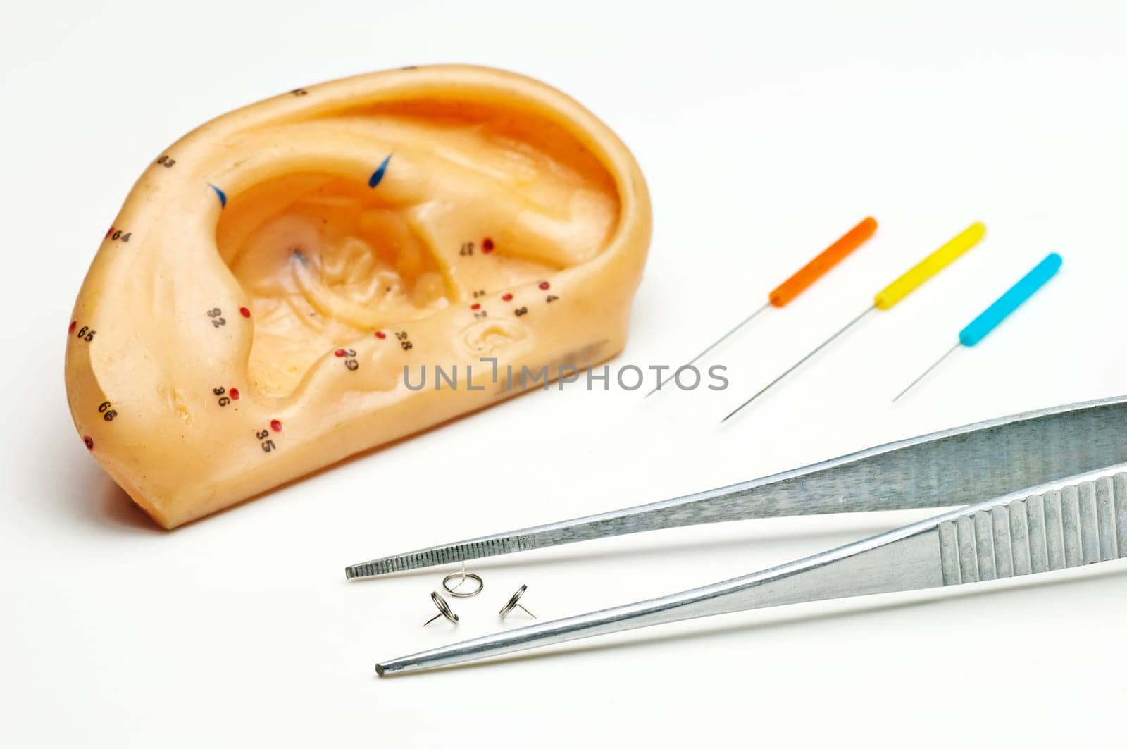Ear Acupuncture