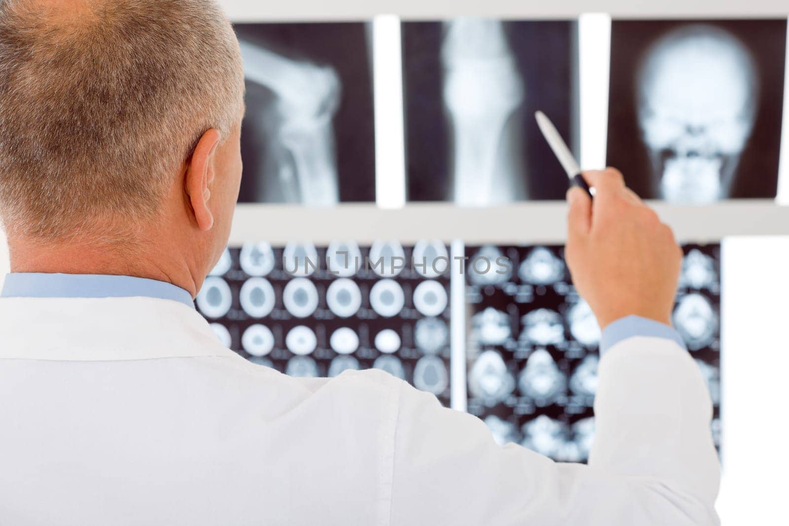 Professional male senior doctor pointing at set of x-rays