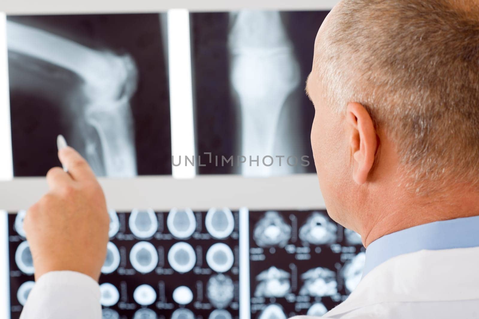 Professional male senior doctor pointing at set of x-rays