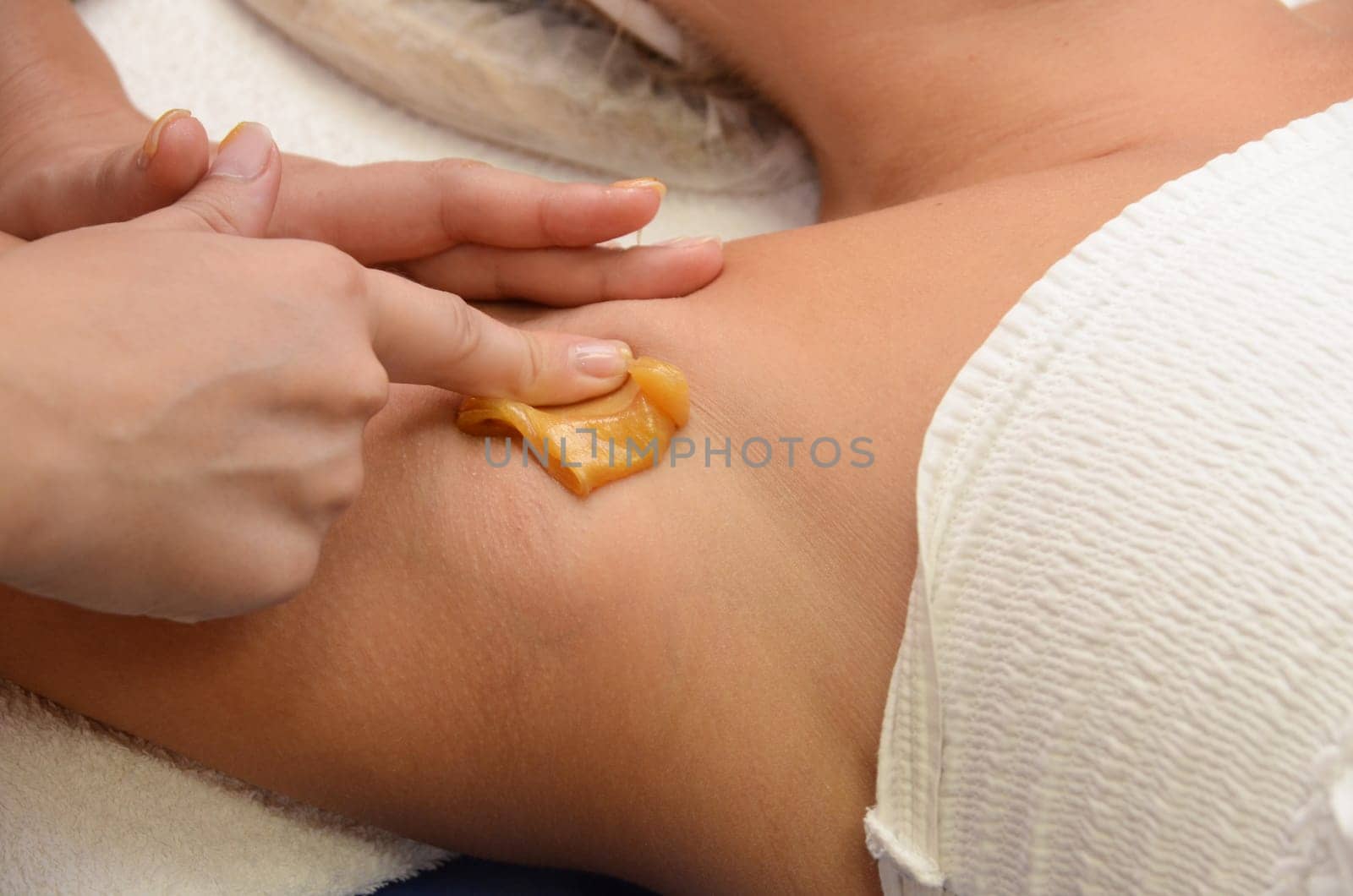 Sugaring: epilation with liquate sugar at armpit.