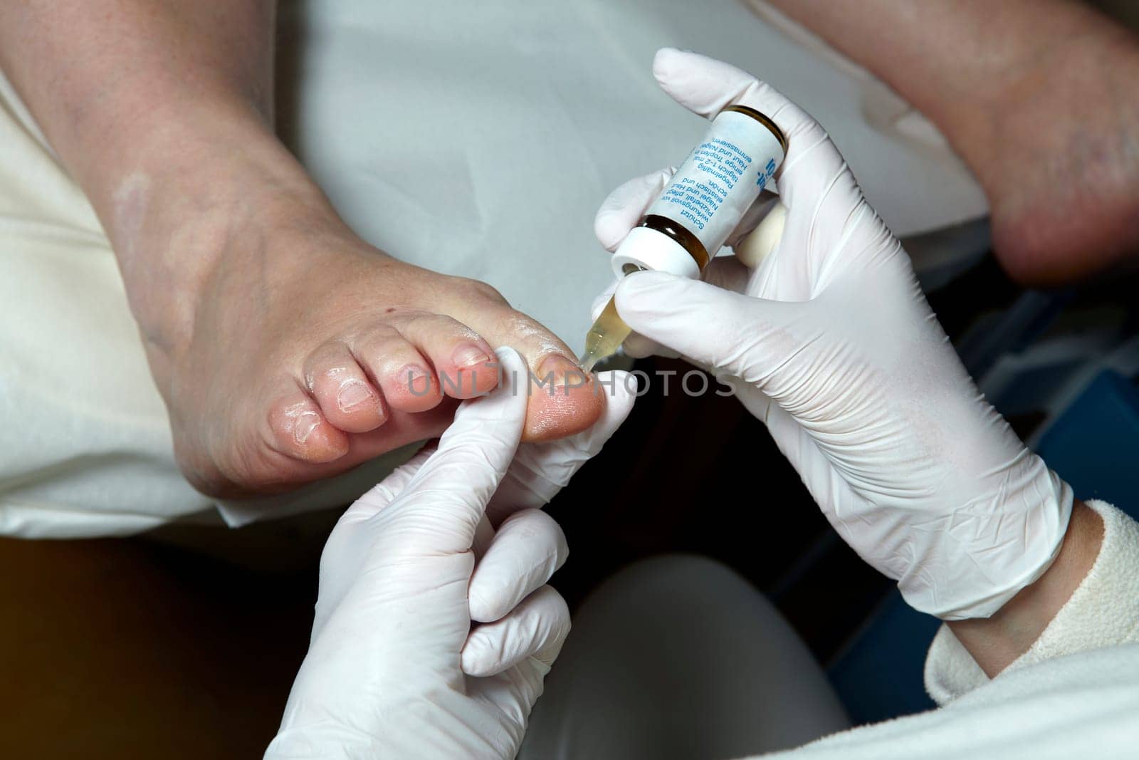 Medical Foot Care - Foot care - Chiropody