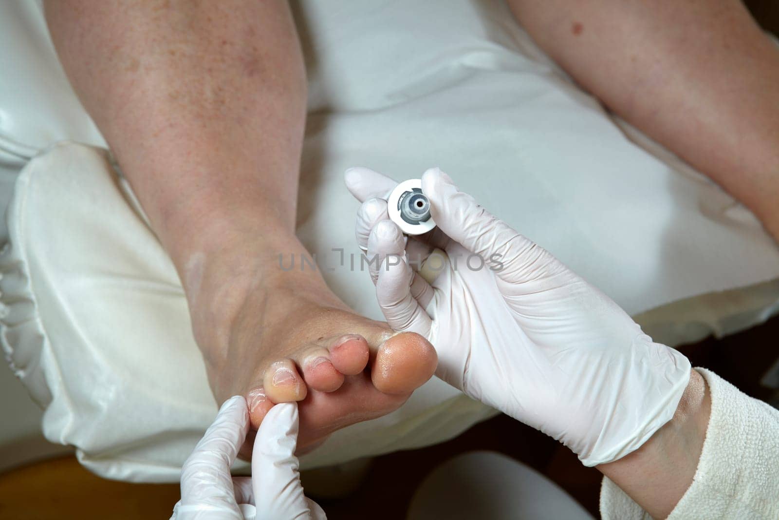 Medical Foot Care - Foot care - Chiropody