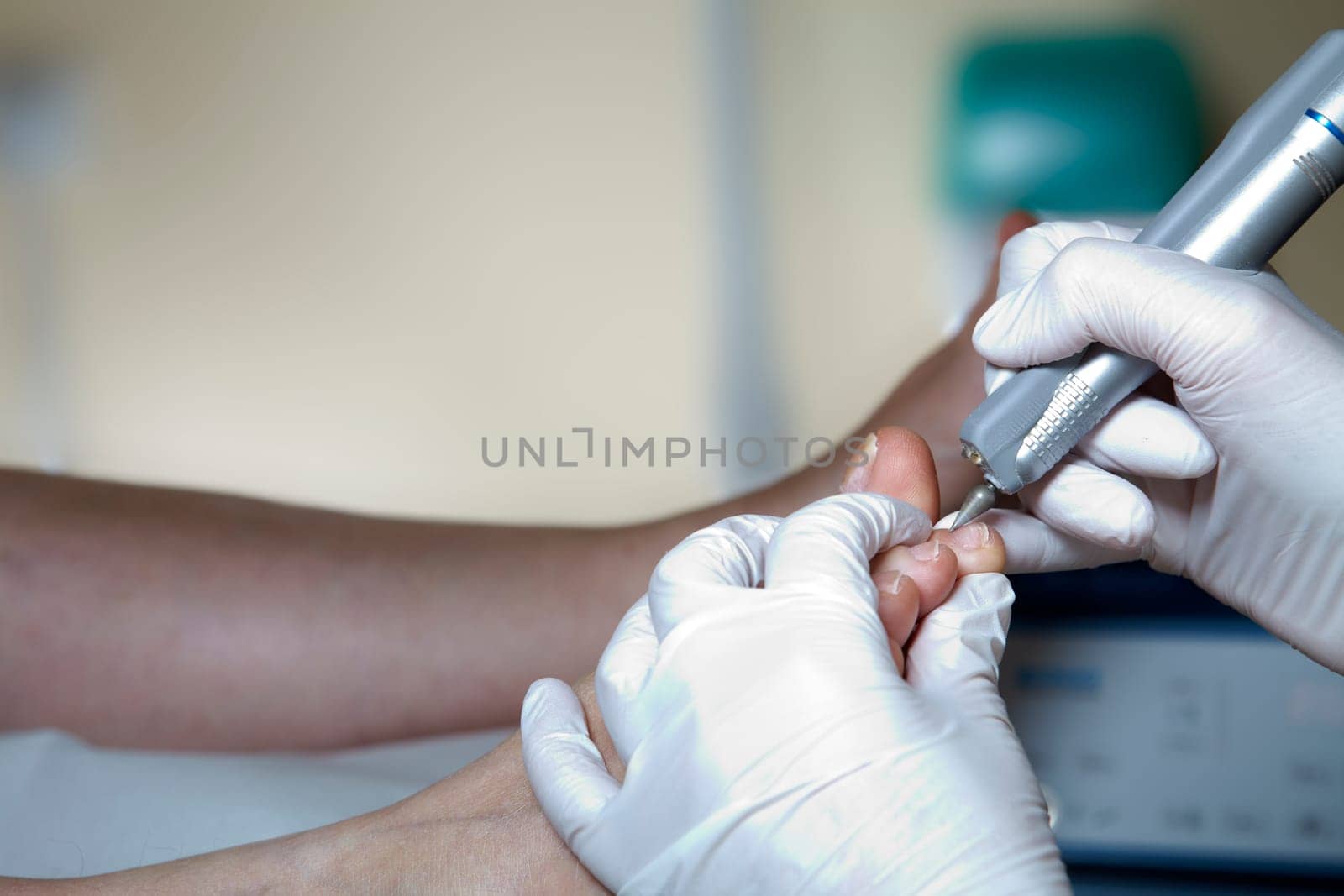 Medical Foot Care - Foot care - Chiropody