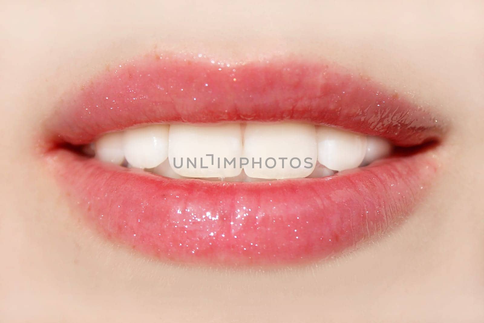 The perfect teeth