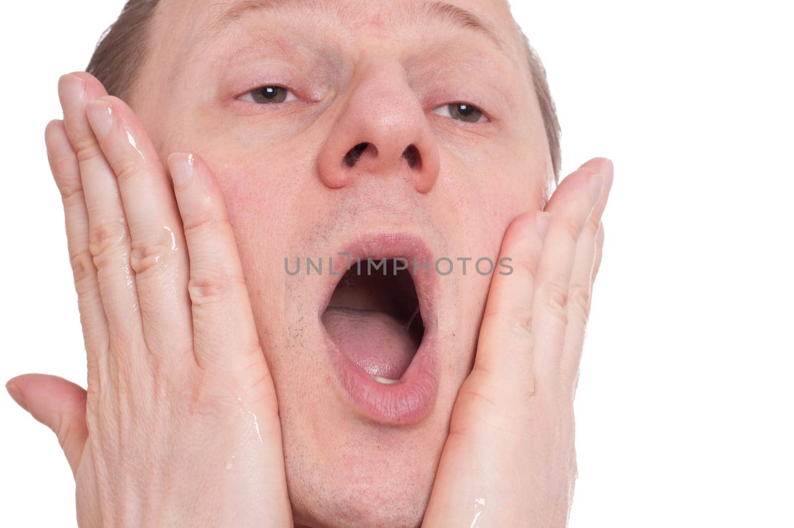 A man has pain when rubbing with aftershave