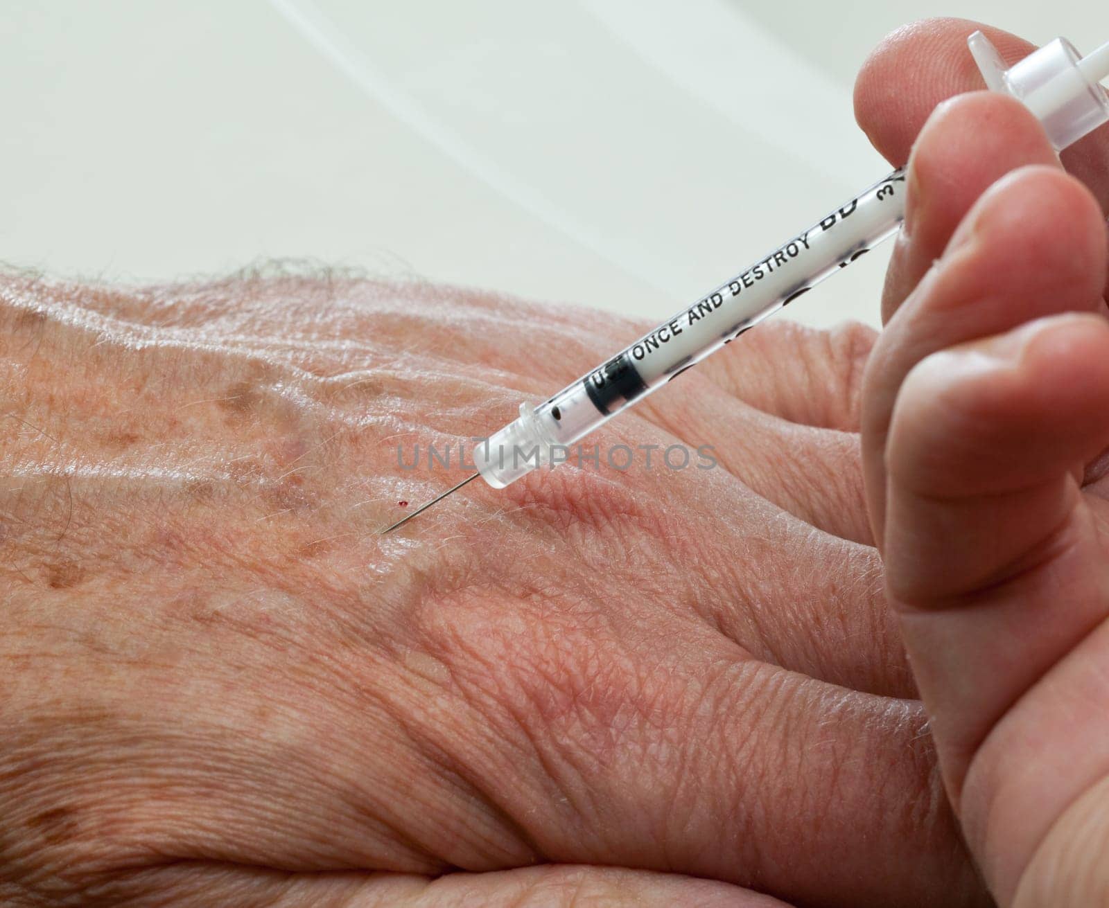 Injection into vein of senior man hand from small hypodermic needle