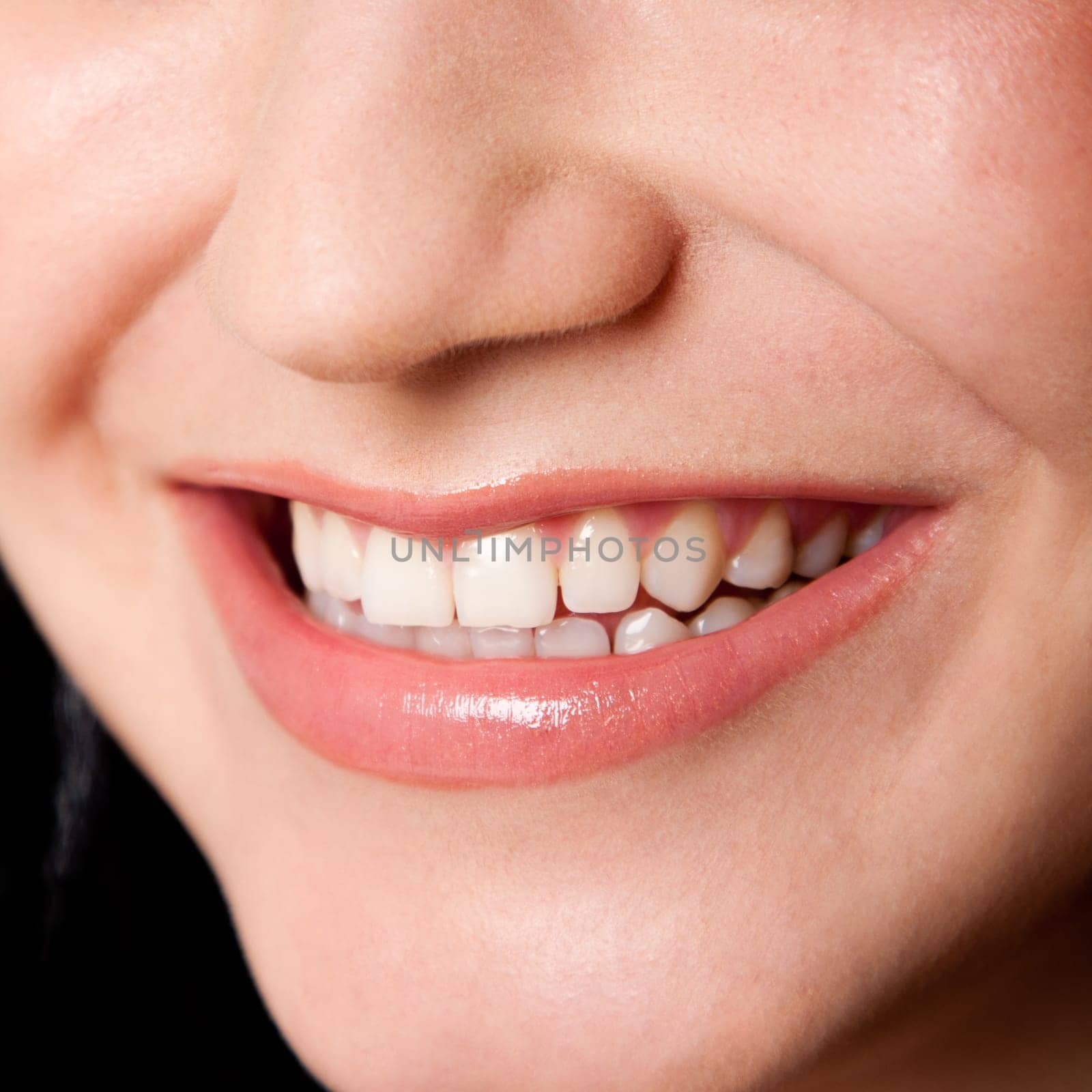 Beautiful white teeth in a perfect happy smile of a female face, dentist tooth whitening concept.
