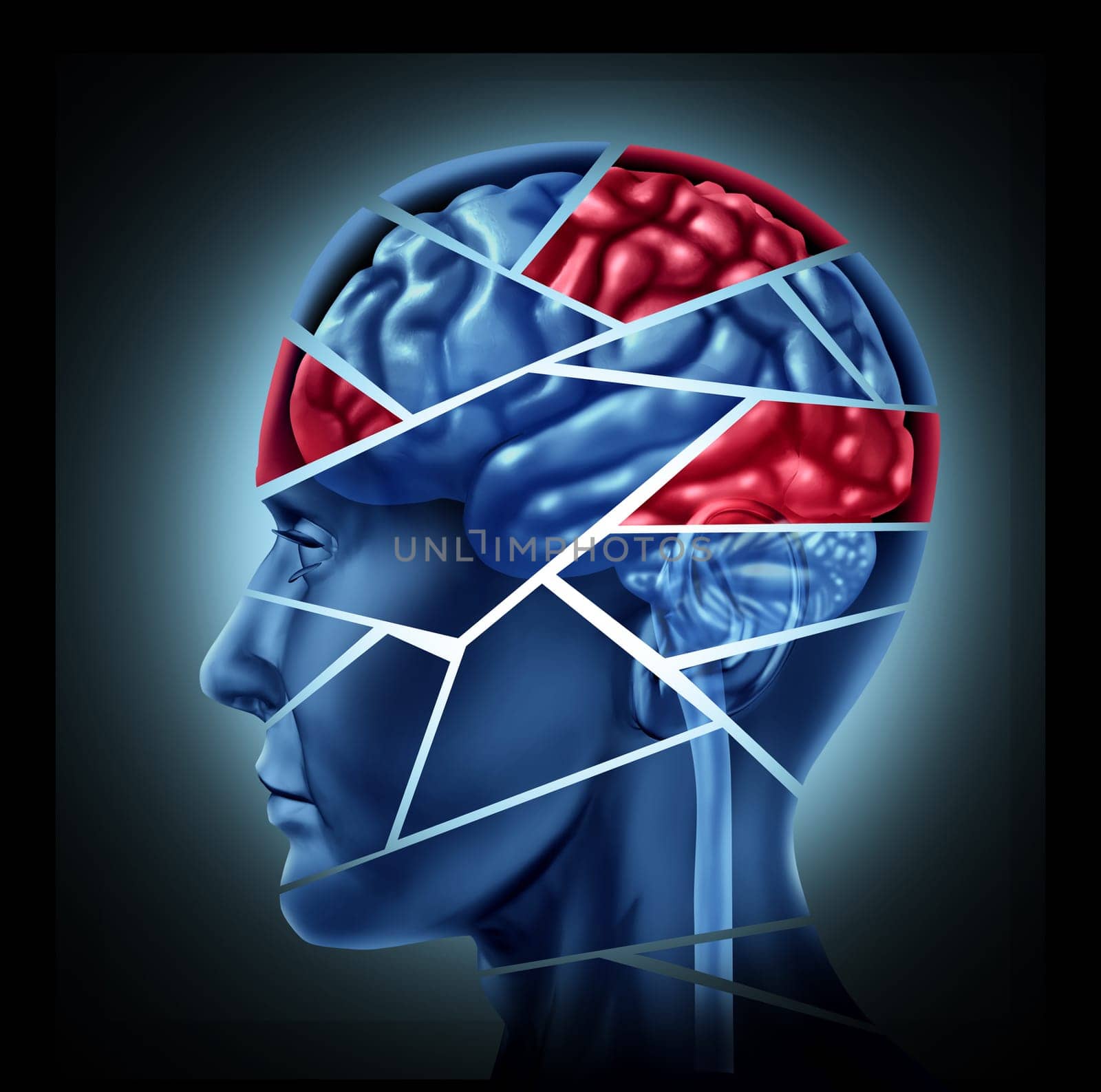 Mental disability with brain injury and neurological disorder represented by a human head and mind broken in pieces to symbolize a severe medical mental trauma and cognitive illness on white background.