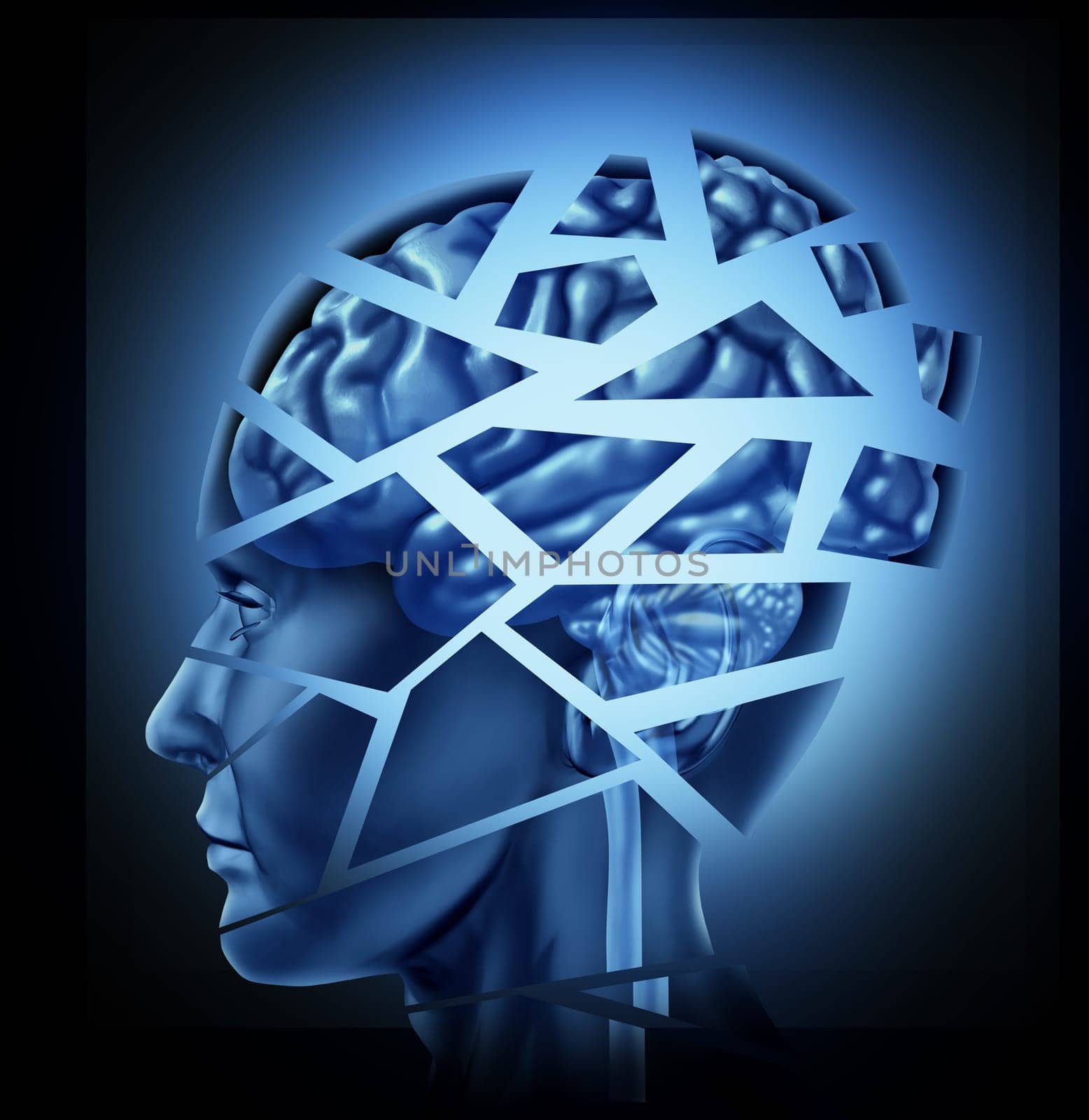 Damaged human brain injury and neurological disorder represented by a man&#039 s head and mind broken in pieces to symbolize a severe medical mental trauma and cognitive illness on black background.