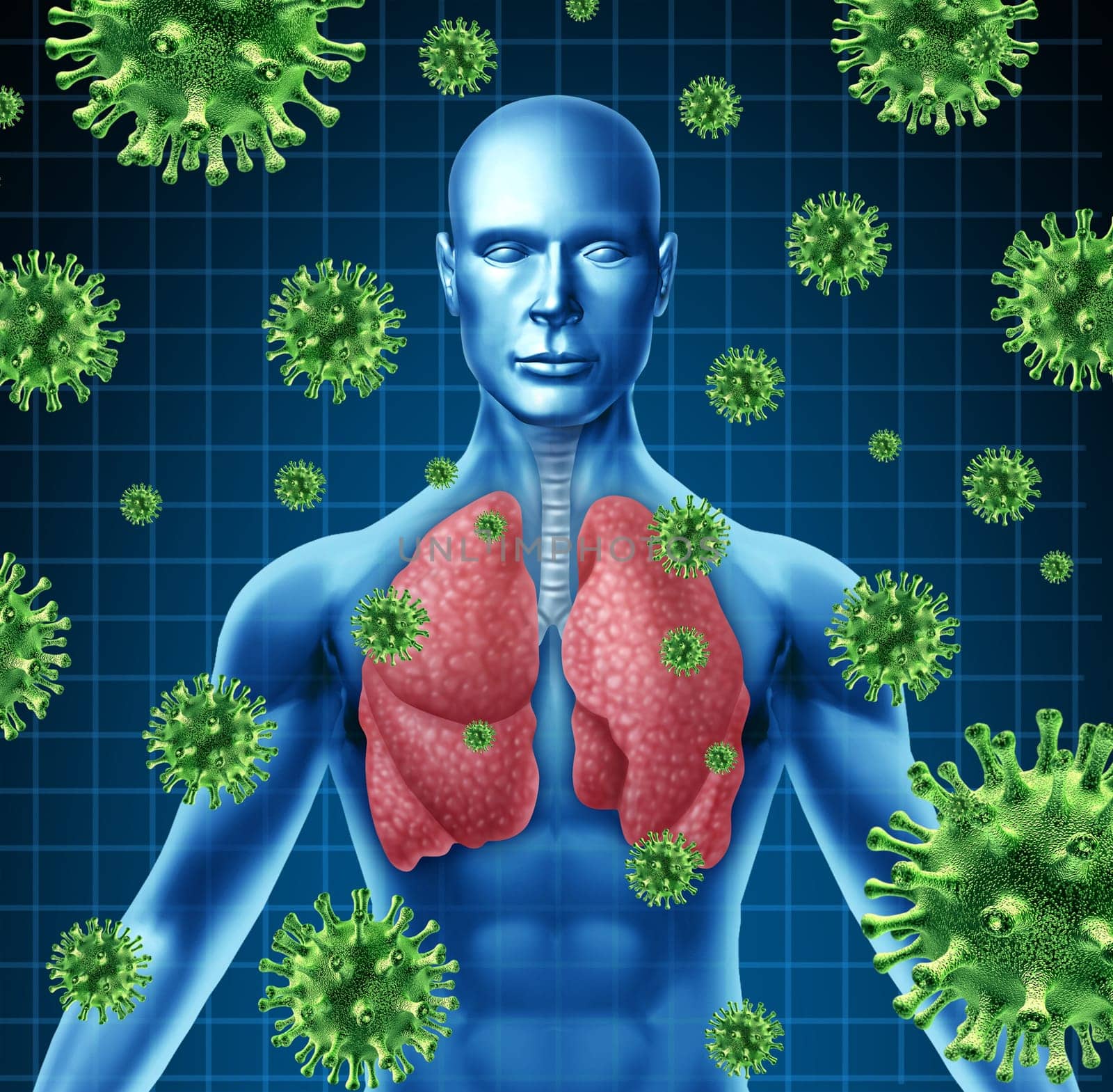 Lung infection represented by a human with x-ray image of the lungs and body with virus cells attacking the patient to a state of dangerous respiratory illness.