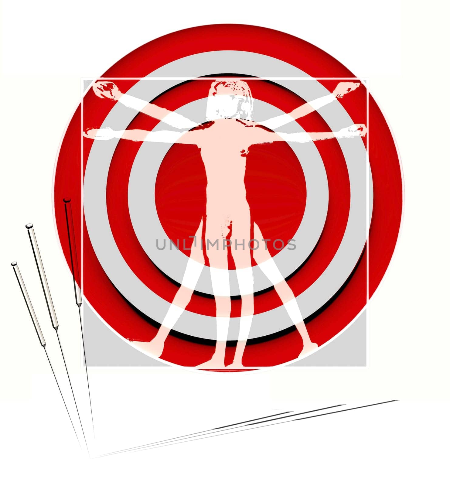 Acupuncture