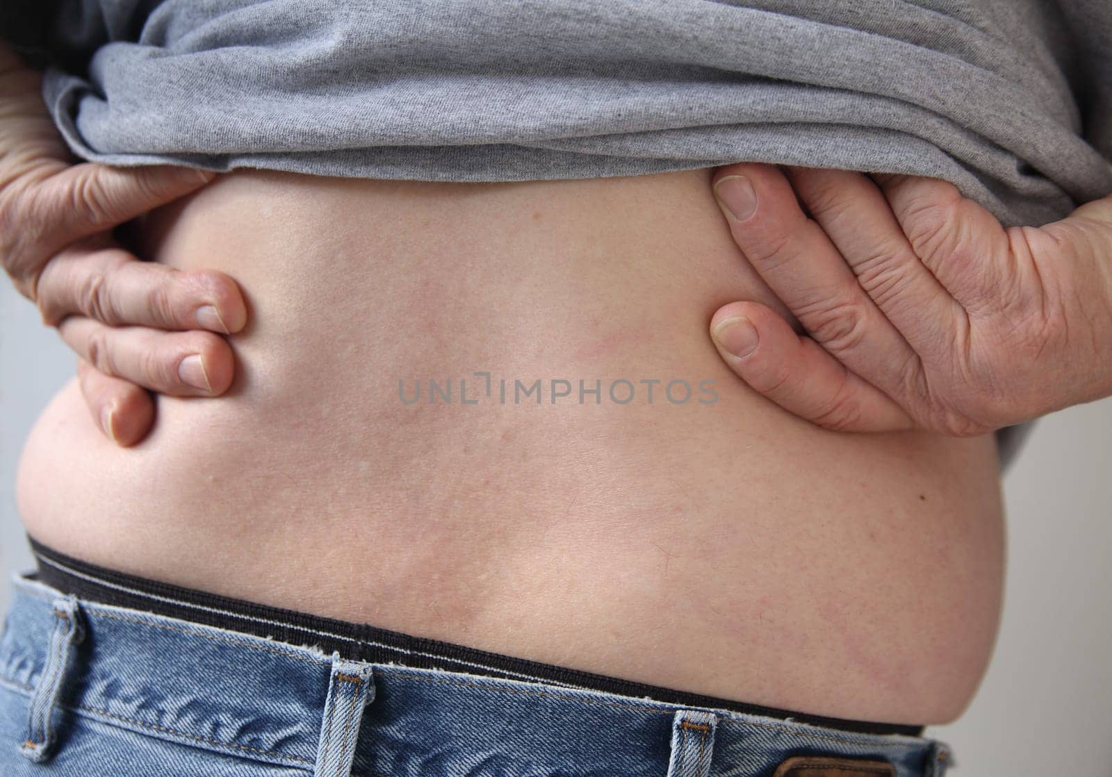 a man suffering from a backache