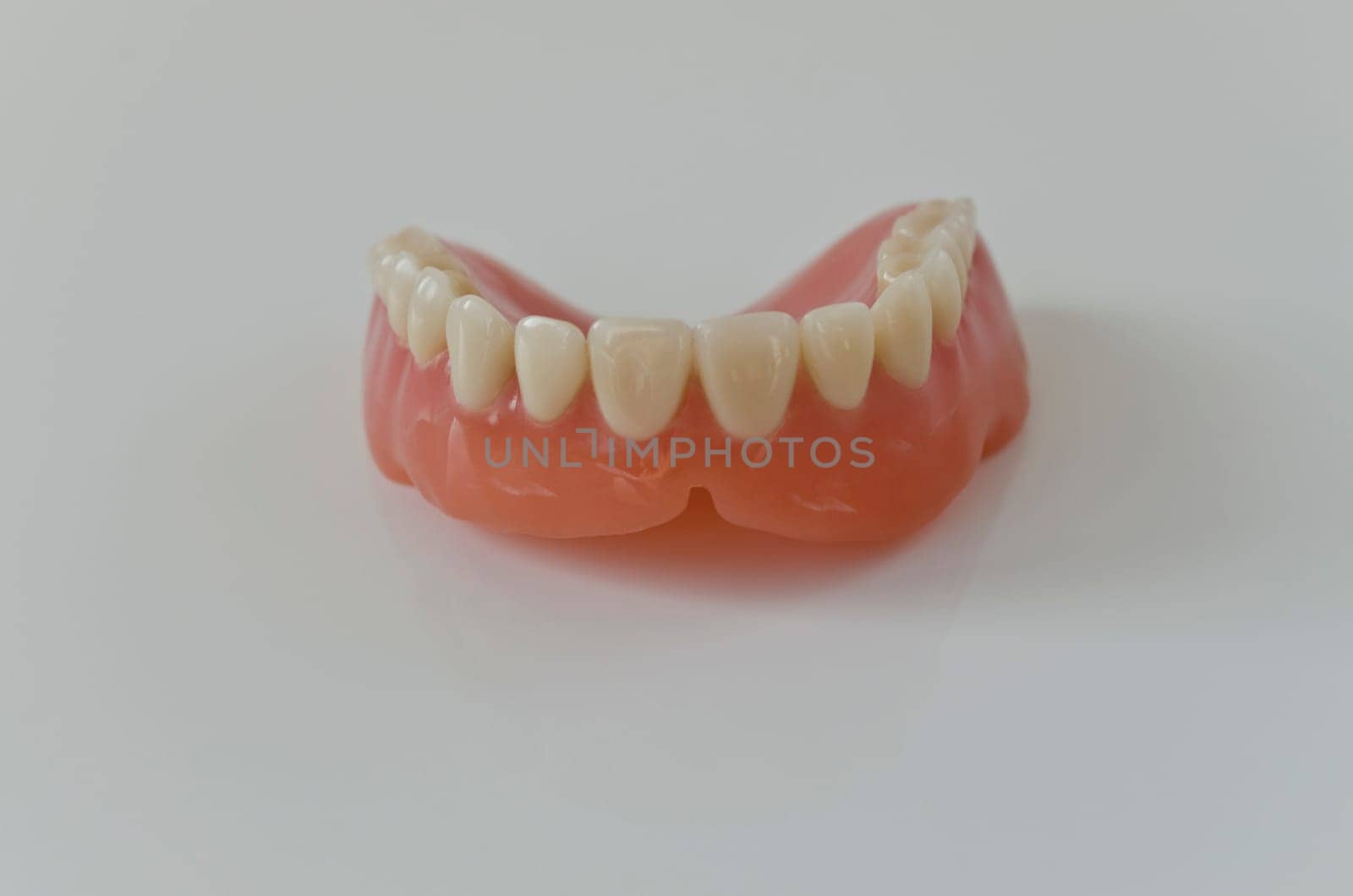 Removable dentures (ceramic)