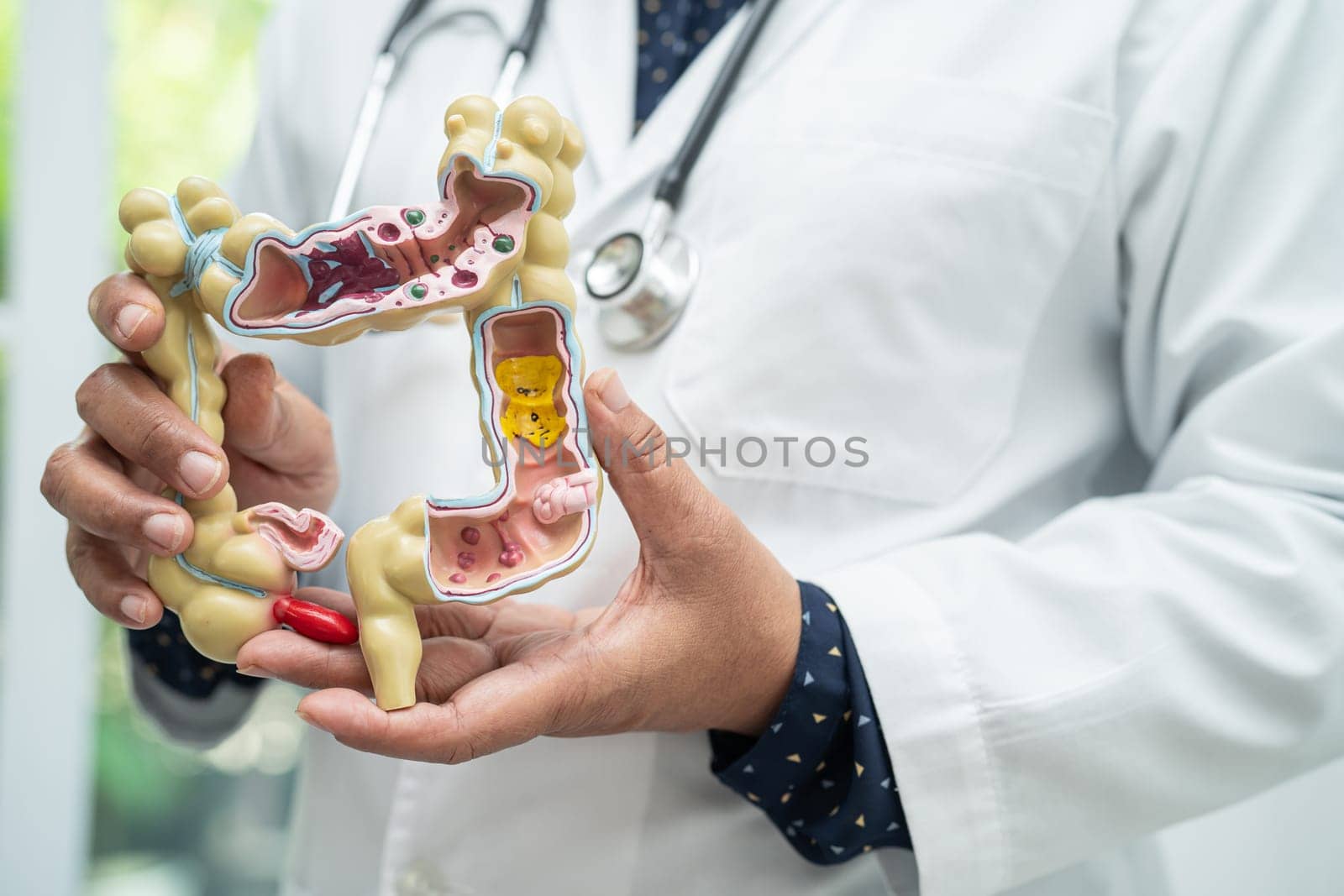 Intestine, appendix and digestive system, doctor holding anatomy model for study diagnosis and treatment in hospital.